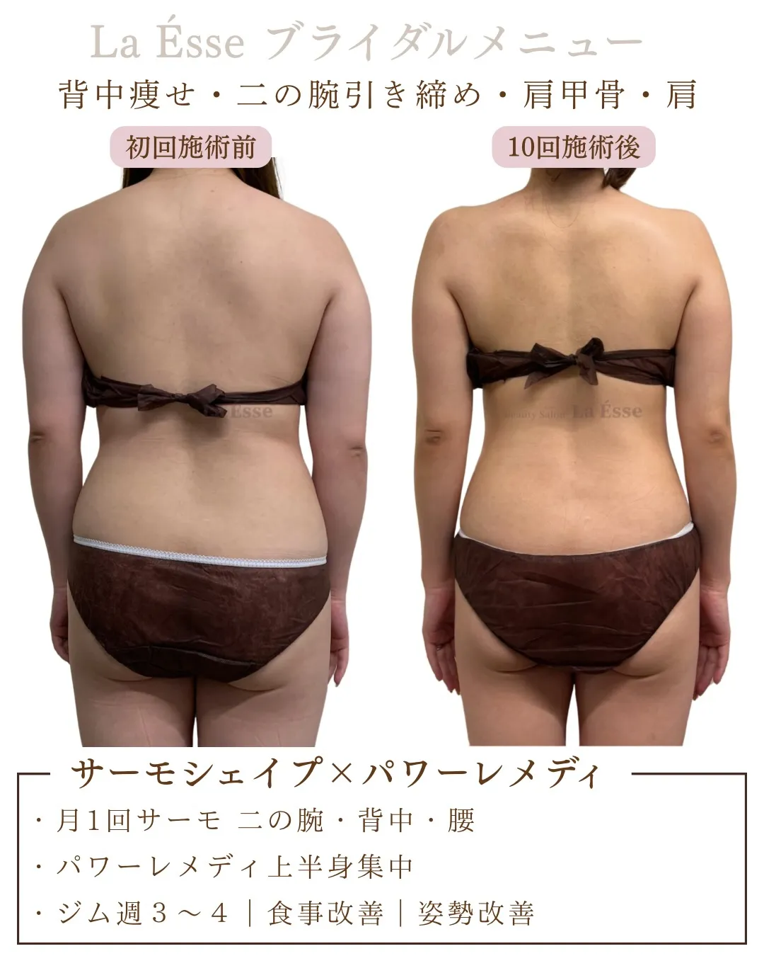 花嫁様必見💎 月1回でもここまで変わる…?🥹✨