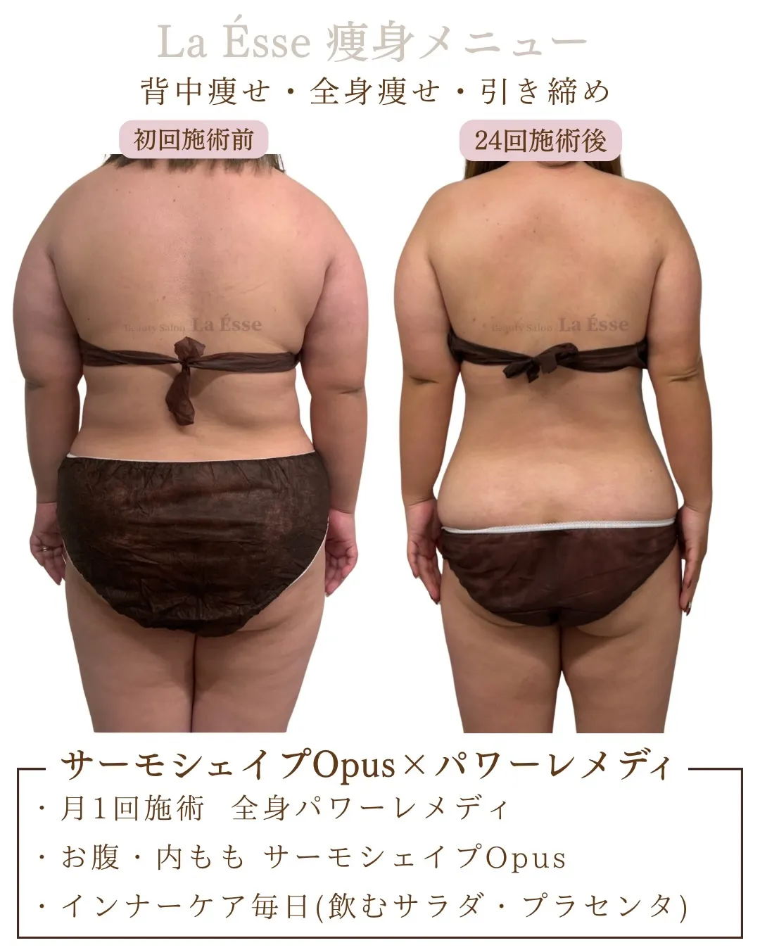 後ろ姿別人！！月1回施術で加工レベルに変われます✨