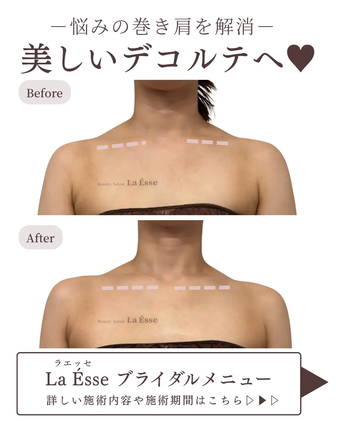 もりっとした肩から卒業💎 凝り解消→映えるデコルテへ✨