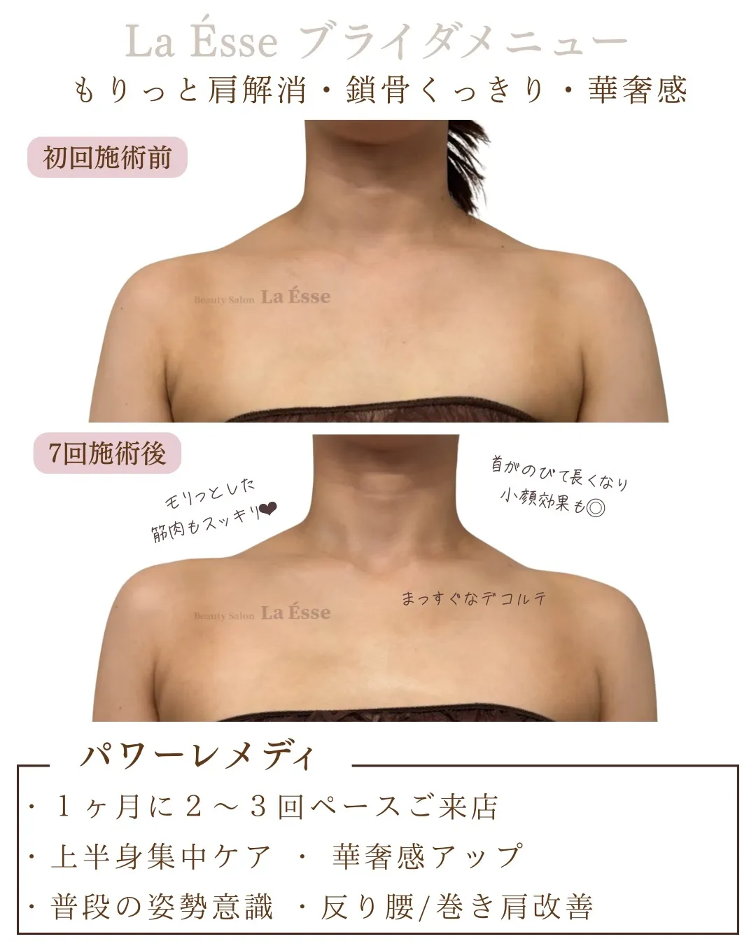 もりっとした肩から卒業💎 凝り解消→映えるデコルテへ✨