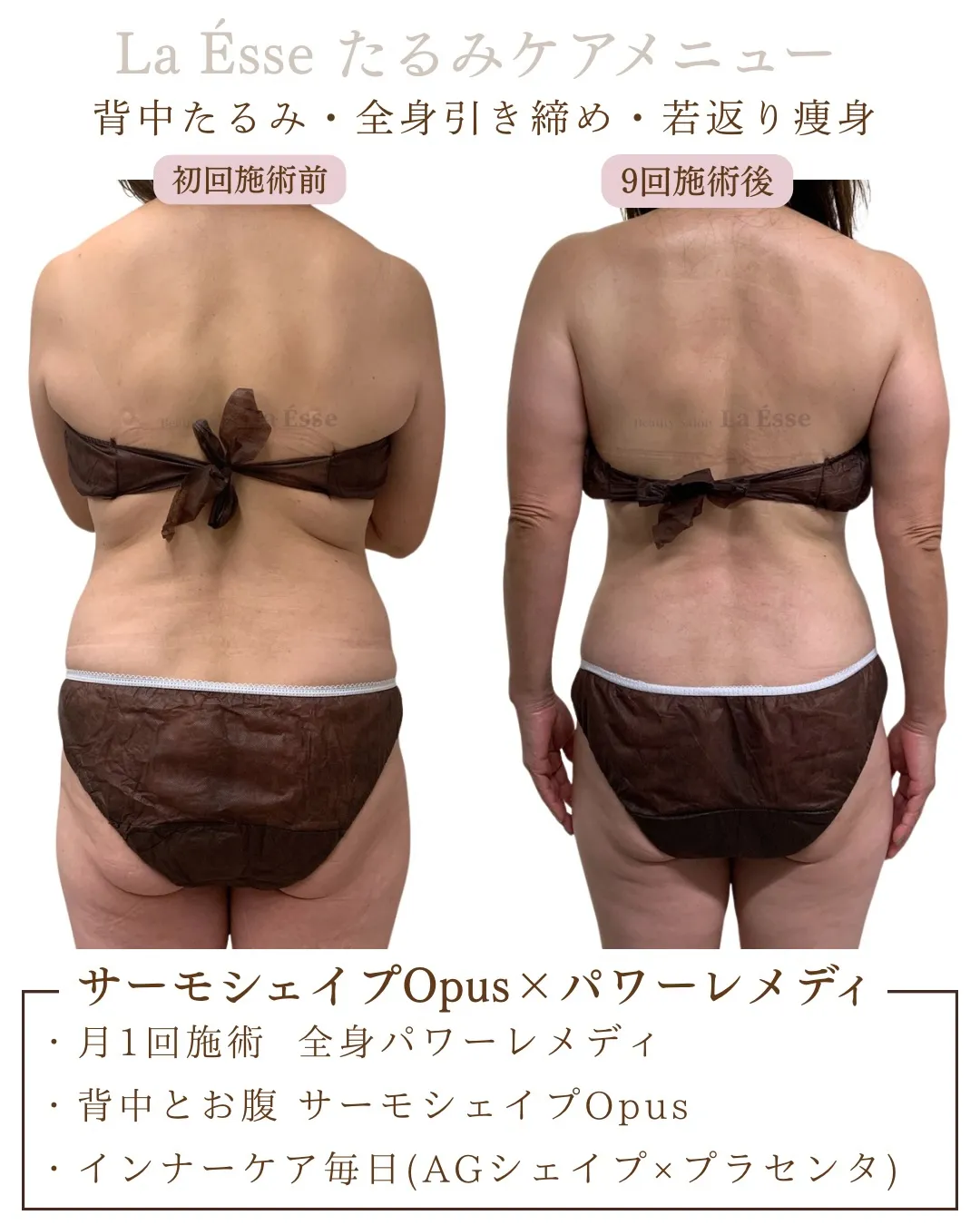 隠しきれない【年齢サイン】背中に出ていませんか？🥹 ぷよっと...