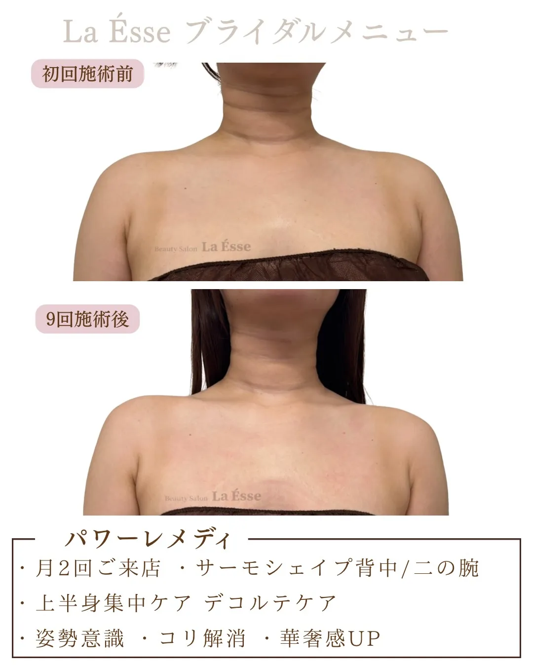 コリ解消で美しい鎖骨が現れる◎ 時間がない花嫁様にも💖