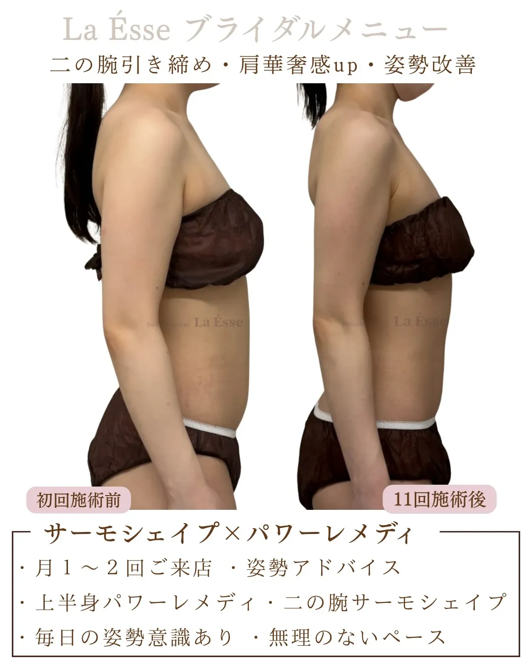 ぷよっと二の腕を卒業👰🏻♀️ 本気の花嫁様お待ちしておりま...