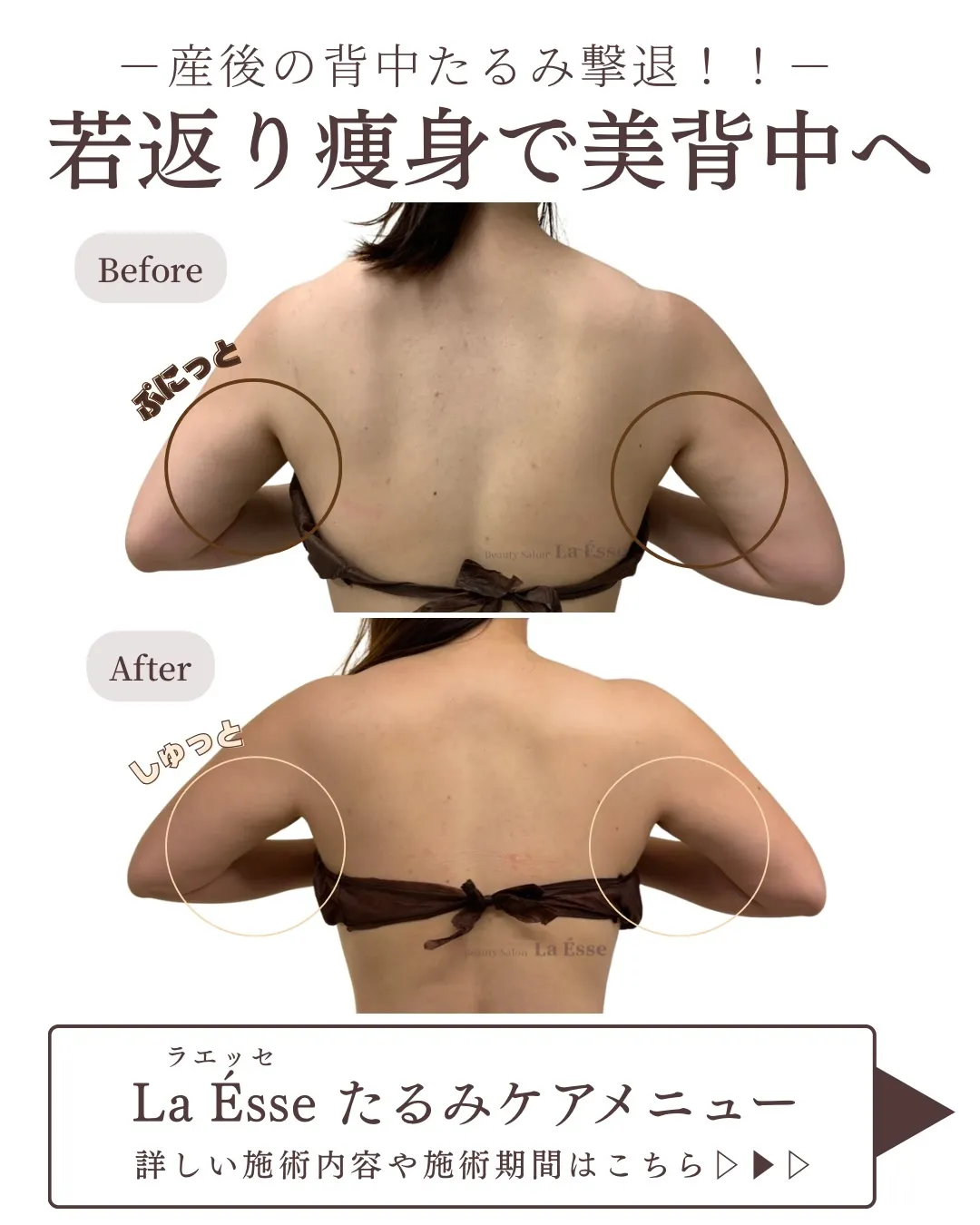 産後放置しがちの背中のたるみも若々しく引き締めちゃう💪🏻