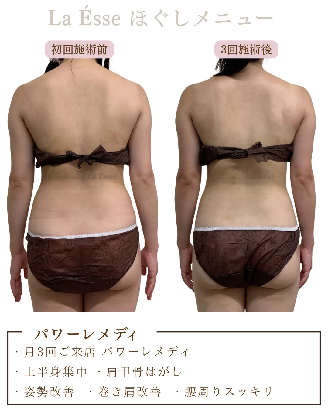 ３回筋膜リリースでなで肩から卒業へ✨ 背中スッキリ‼️