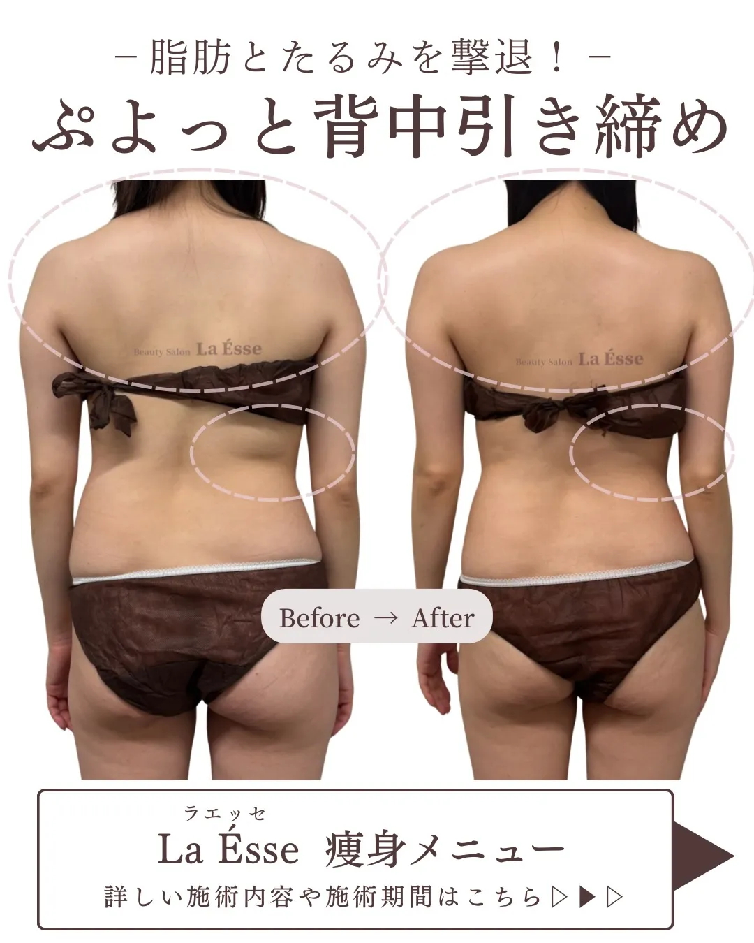 ぷにっとしたお背中・後ろ姿 卒業して老け印象から卒業！🩵
