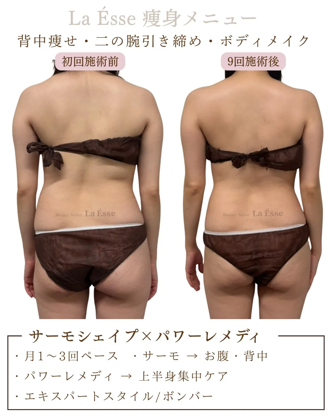 ぷにっとしたお背中・後ろ姿 卒業して老け印象から卒業！🩵