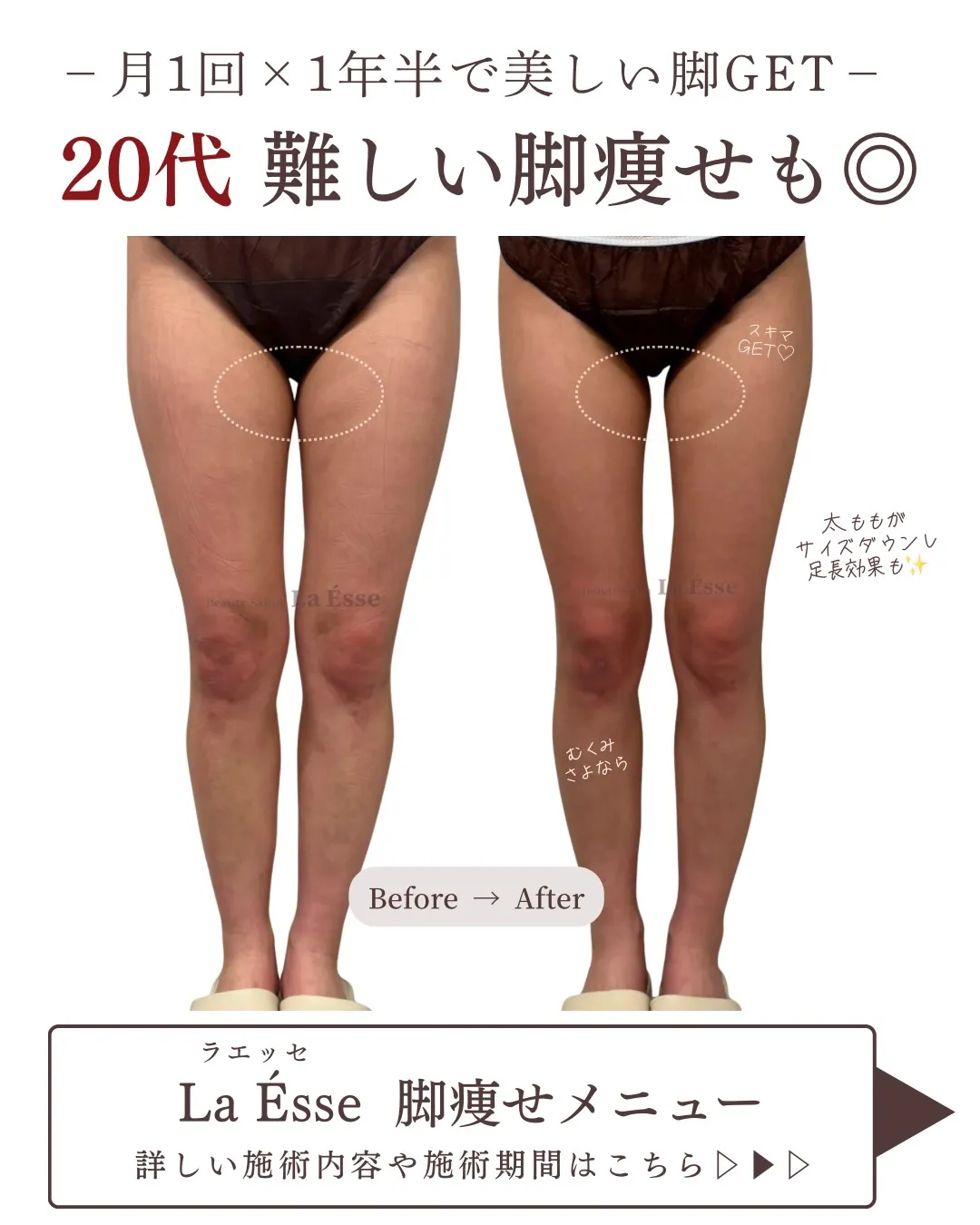 とにかく脚痩せしたい方！！月1~2回お時間下さい✊🏻