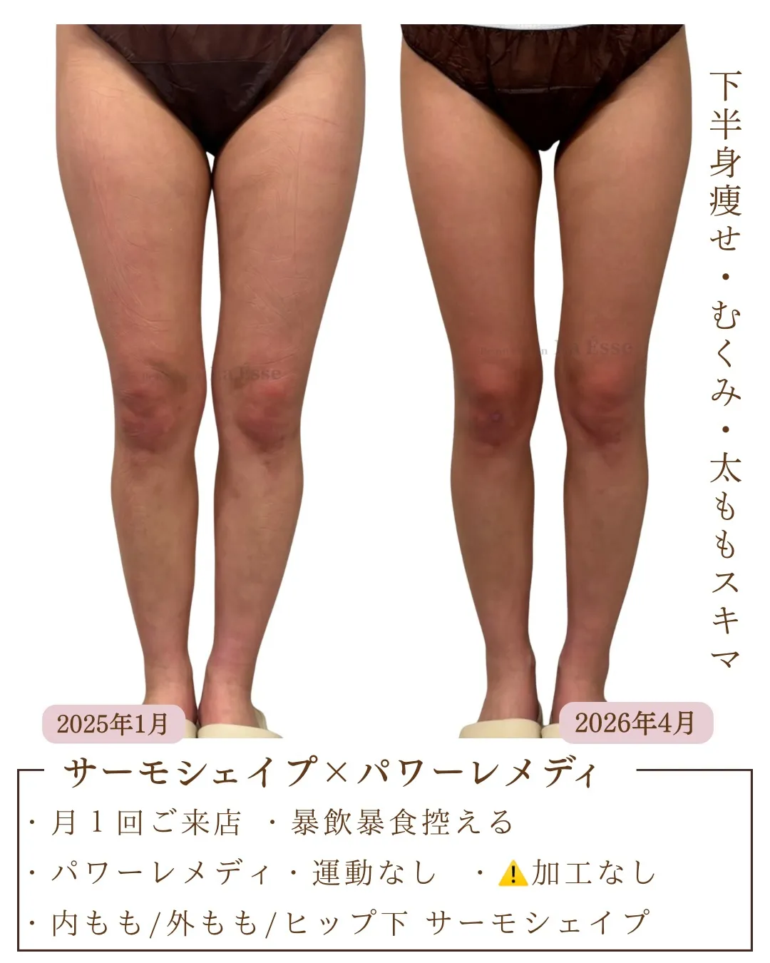 とにかく脚痩せしたい方！！月1~2回お時間下さい✊🏻