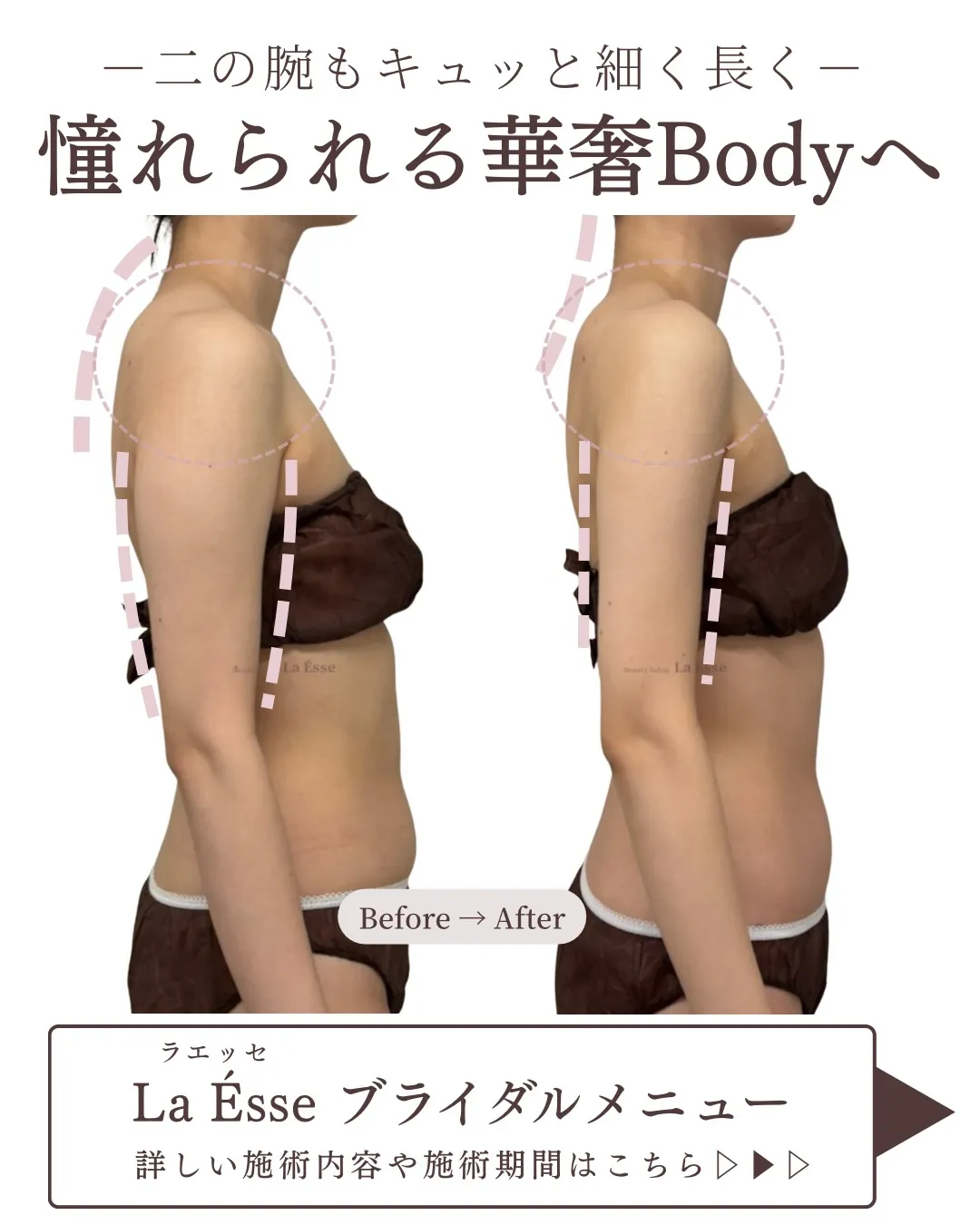四条烏丸でオーダーメイドのブライダルエステ👰🏻‍♀️🩵