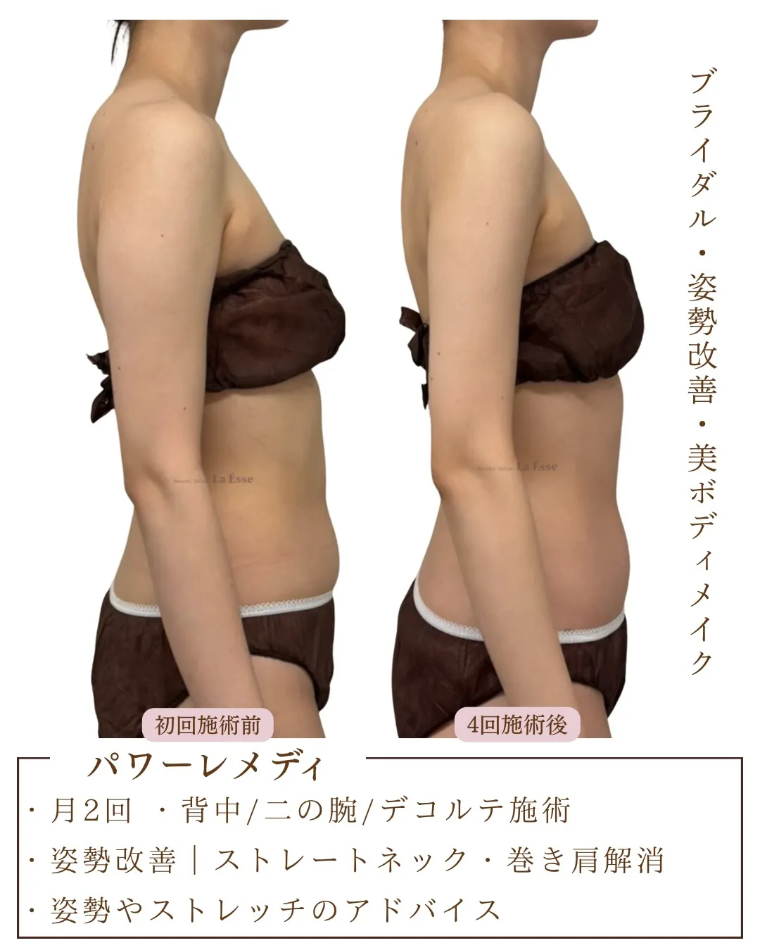 四条烏丸でオーダーメイドのブライダルエステ👰🏻‍♀️🩵