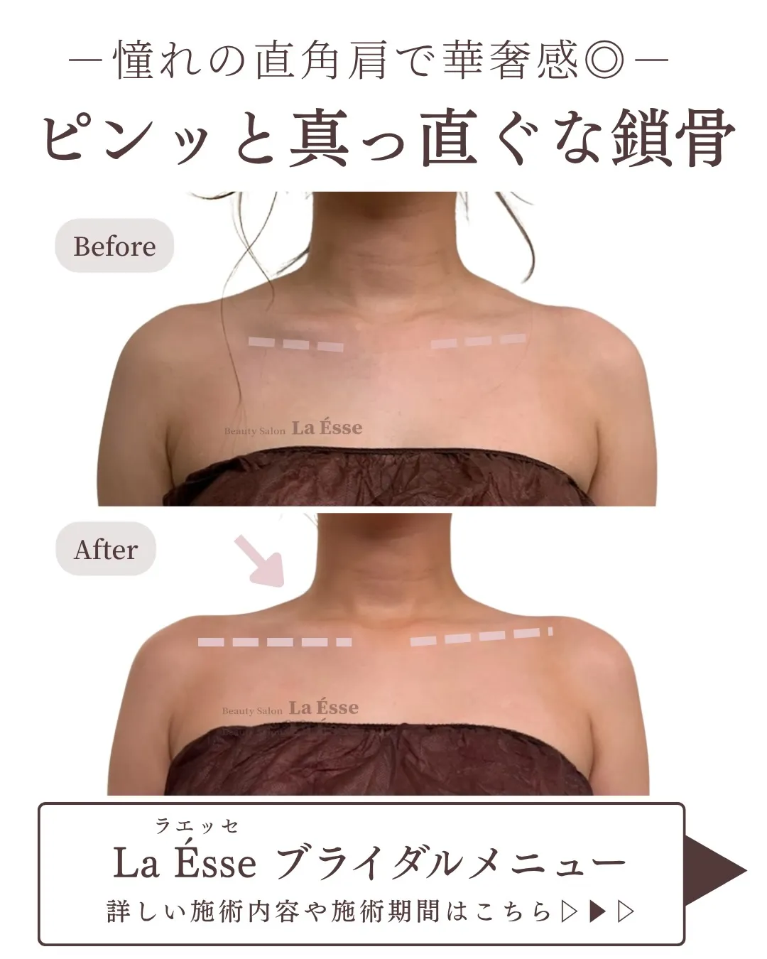 360度どこから見られても、上質な印象を纏う美デコルテ👰🏻‍...