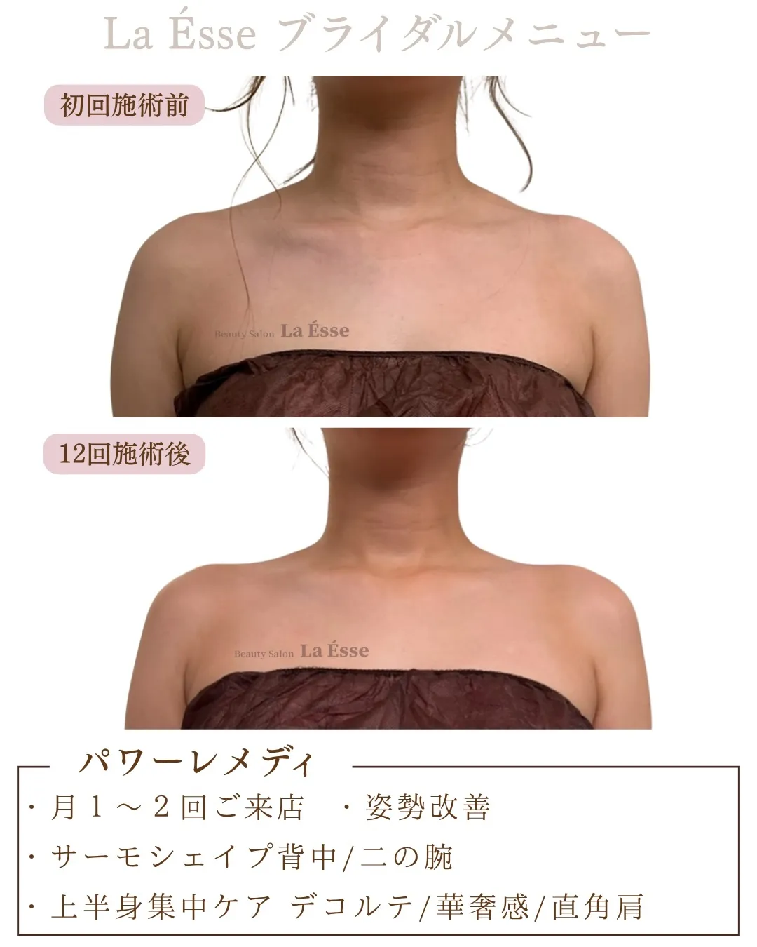 360度どこから見られても、上質な印象を纏う美デコルテ👰🏻‍...