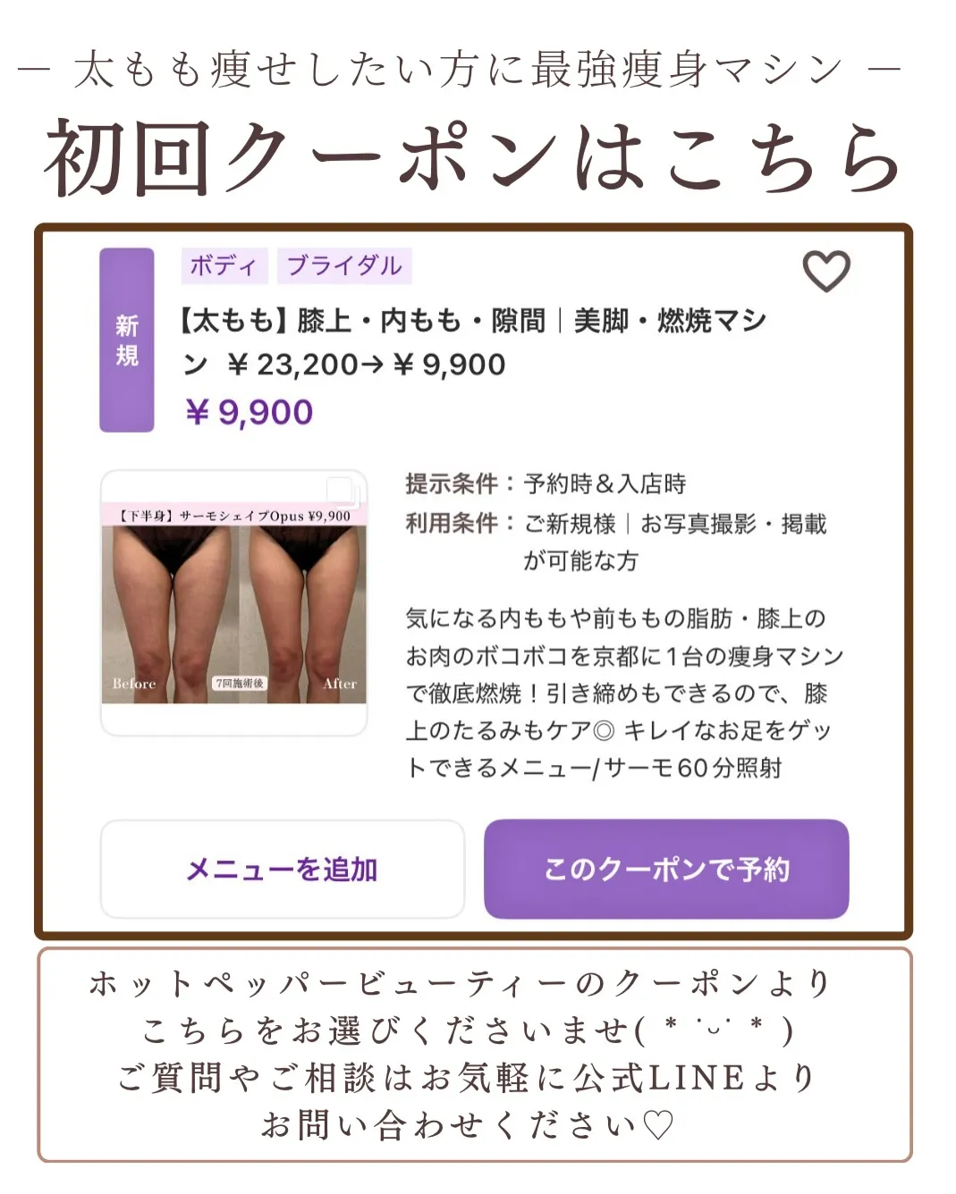 最新高周波で女性らしい丸みヒップGET🍑✨