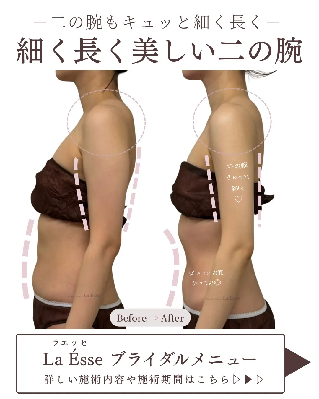 ⁡美しい花嫁様へ変身👰🏻‍♀️ La Ésseのブライダルケ...