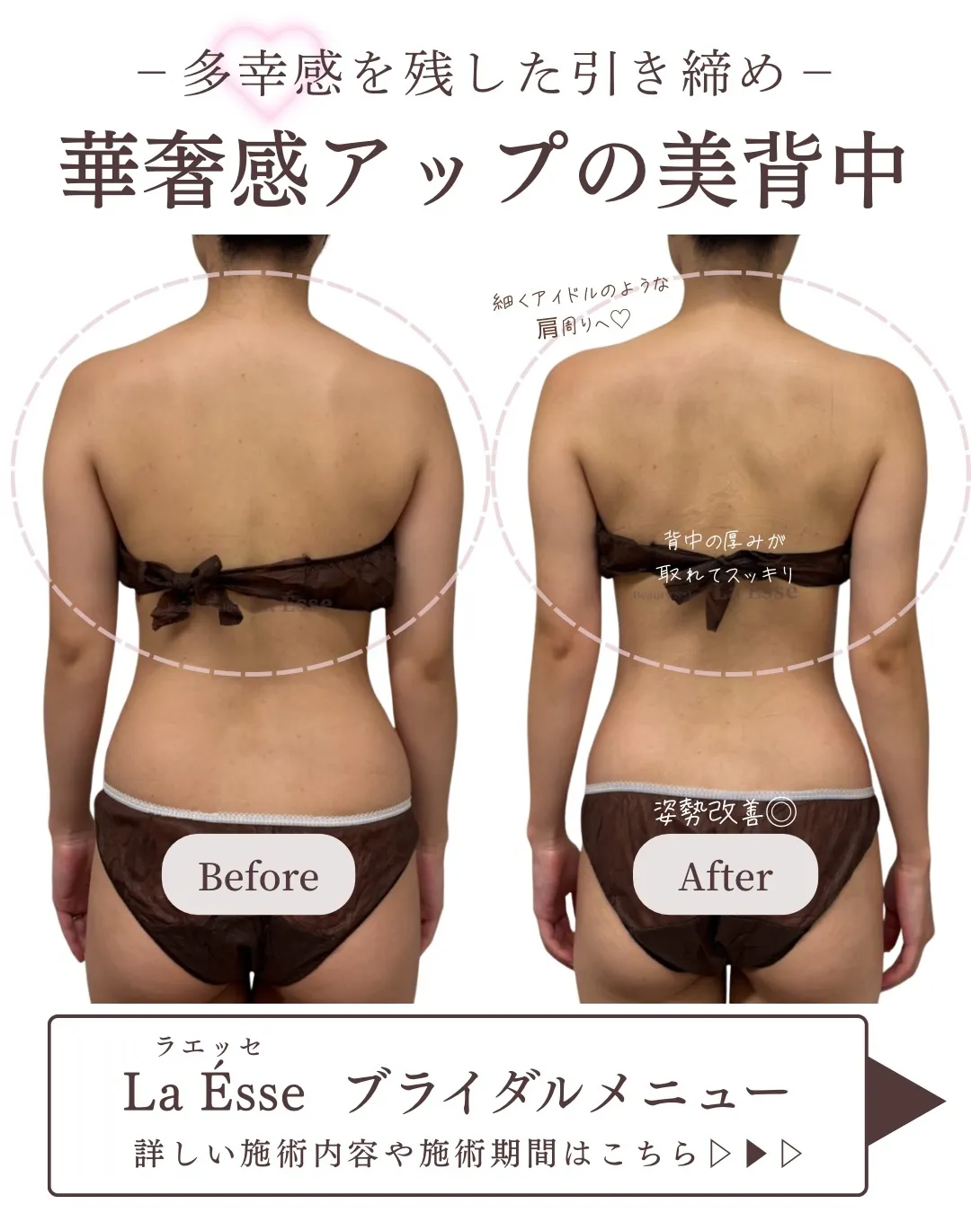 憧れの直角肩！引き締まったお背中はドレス映え間違いなし！💍