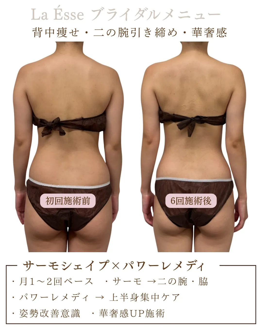 憧れの直角肩！引き締まったお背中はドレス映え間違いなし！💍