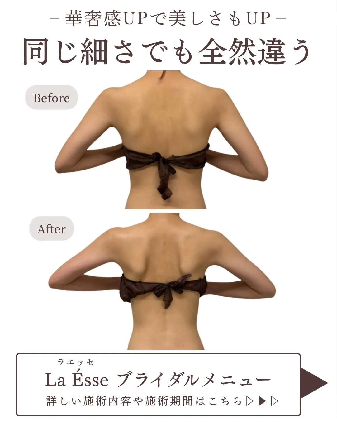 極上筋膜リリースで美しいドレス映えする後ろ姿へ🪞👰🏻♀️✨