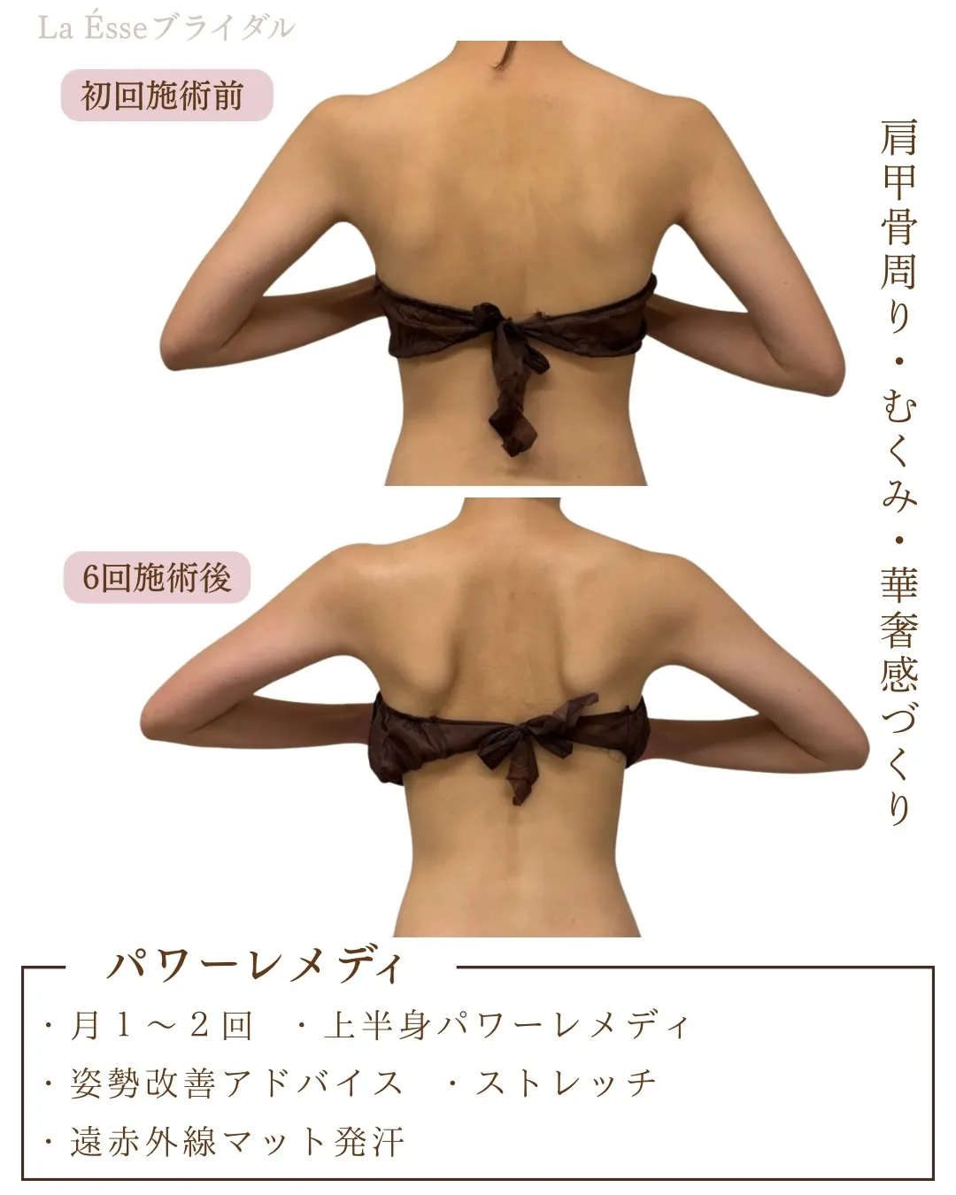 極上筋膜リリースで美しいドレス映えする後ろ姿へ🪞👰🏻♀️✨