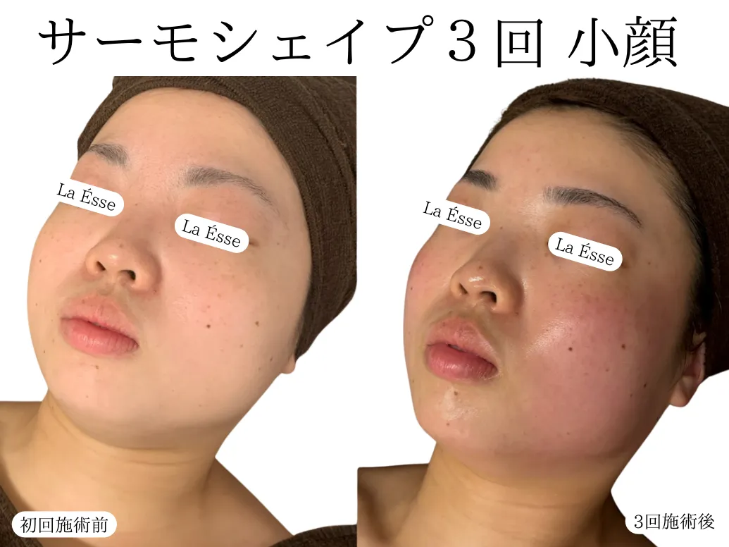 20260603120417.png