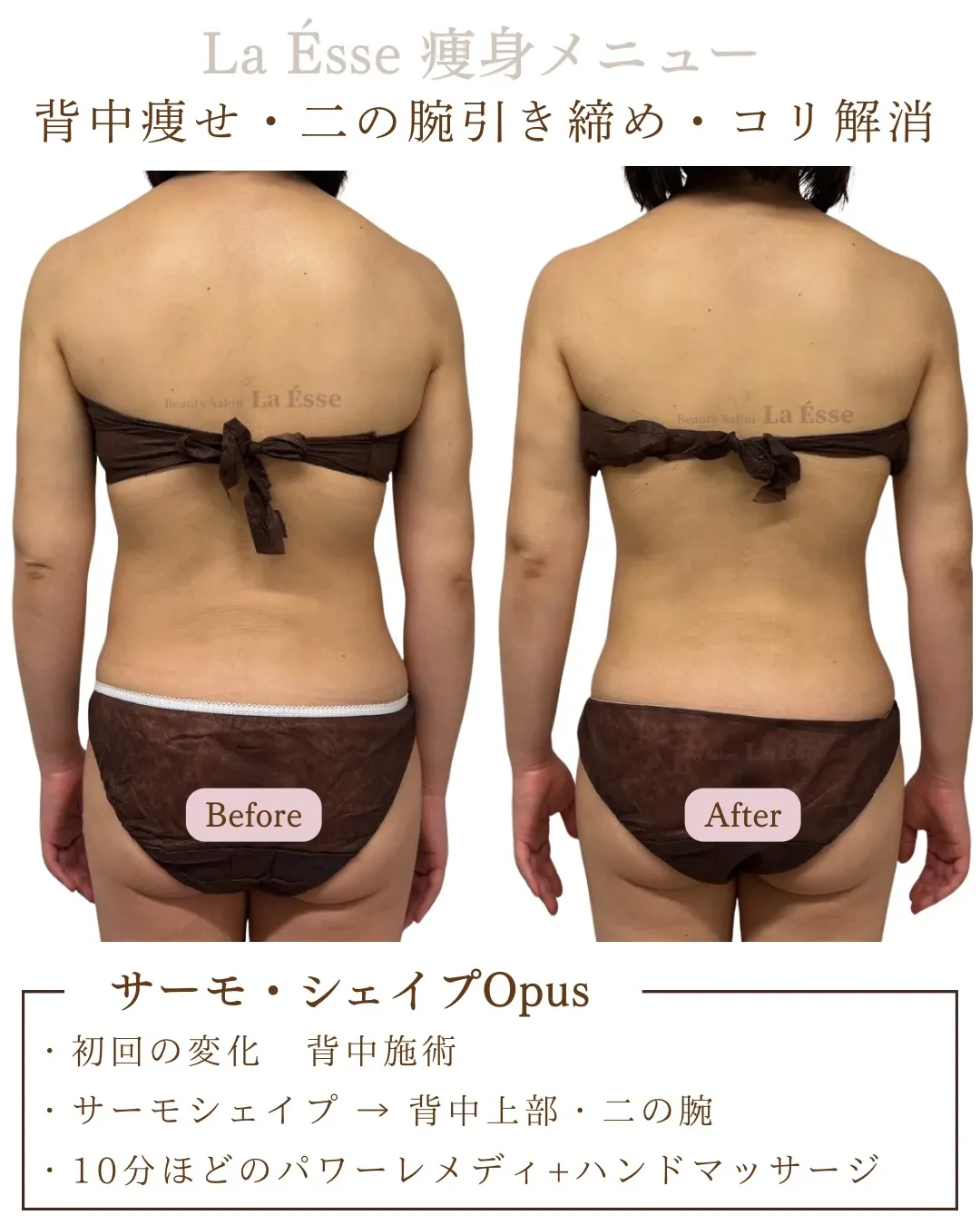 脂肪吸引を選ばなくてもエステで結果を得られる😳✨