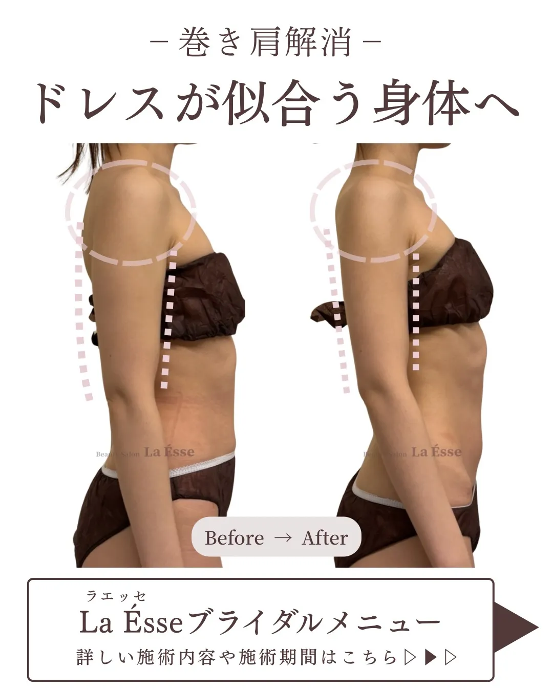 ⁡花嫁様必見!!! 二の腕を引き締めドレス映えするボディへ👰...