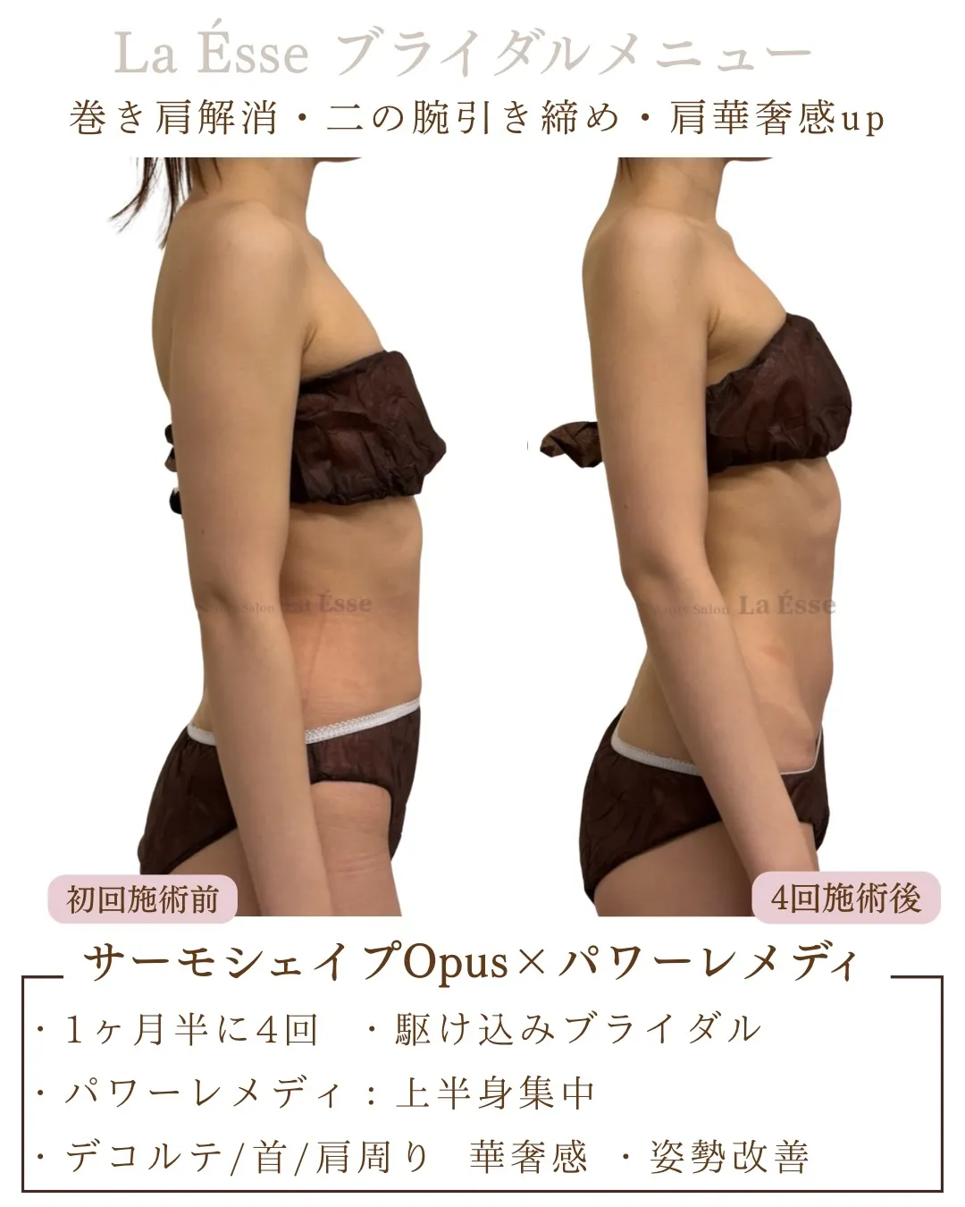 ⁡花嫁様必見!!! 二の腕を引き締めドレス映えするボディへ👰...