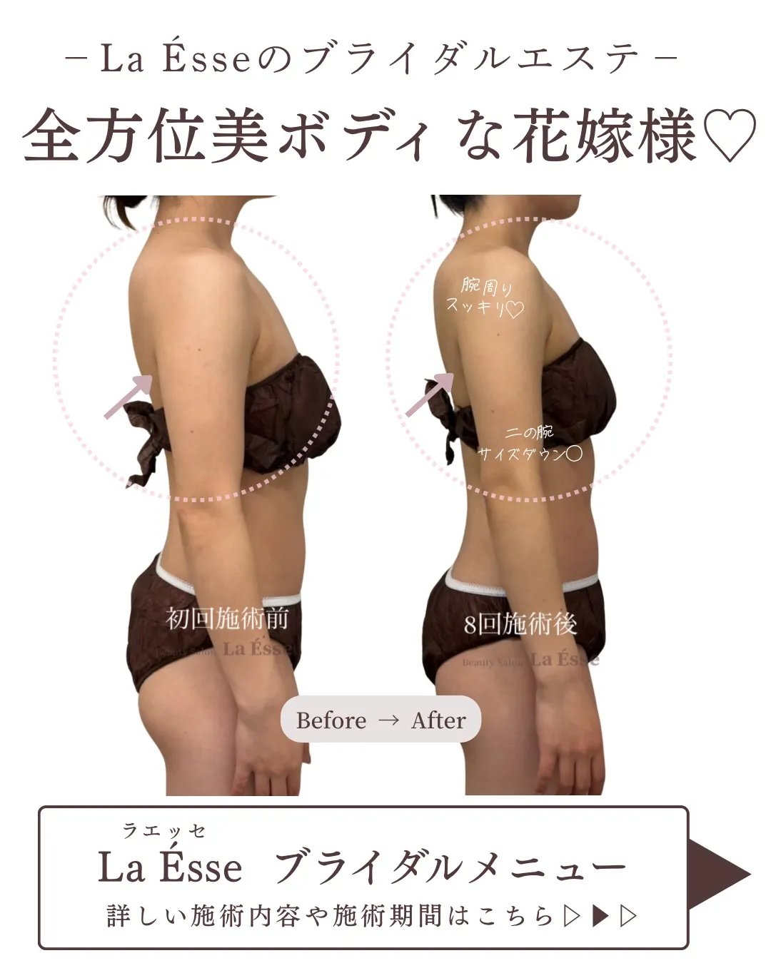 ぷよっと二の腕を卒業👰🏻♀️ 本機で変わりたい花嫁様お待ち...