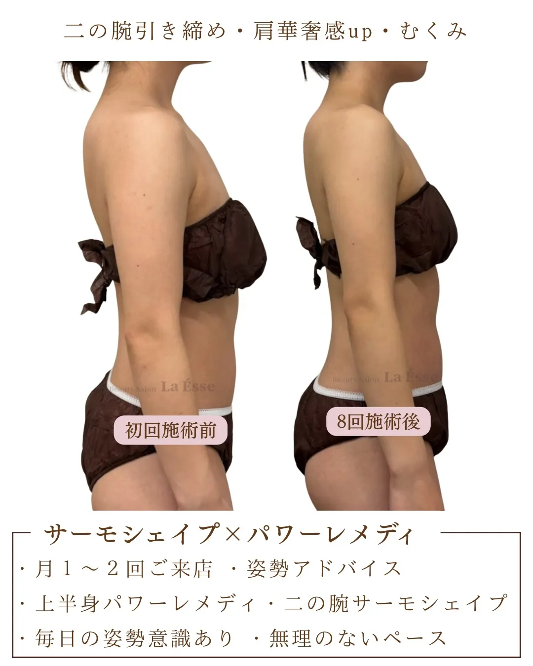 ぷよっと二の腕を卒業👰🏻♀️ 本機で変わりたい花嫁様お待ち...