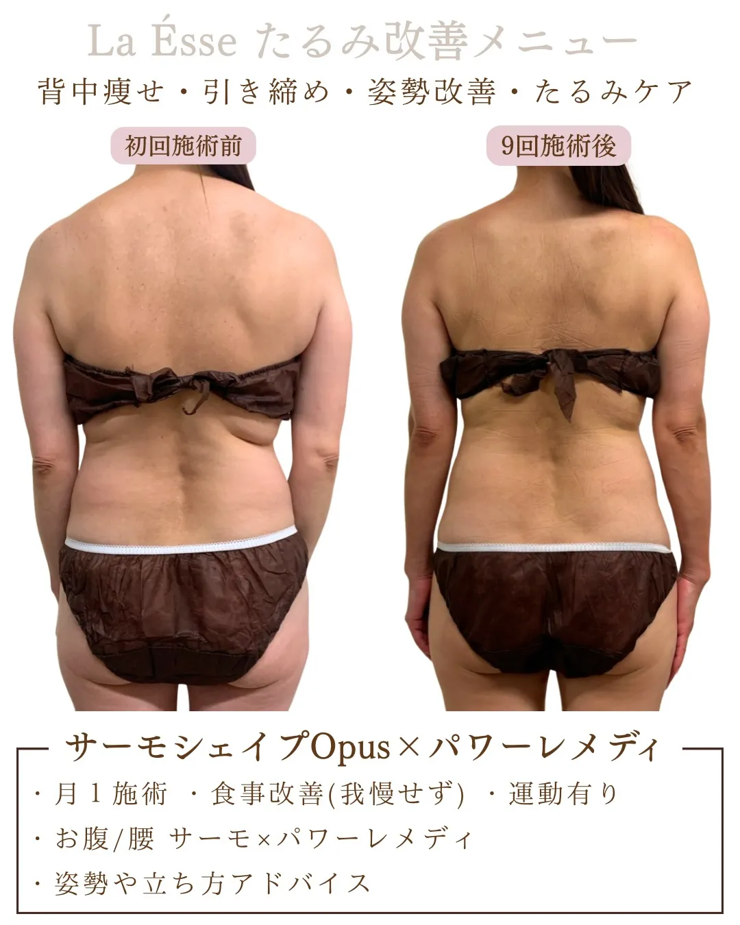 オーダーメイドメニューでたるみ改善︎👍🏻 別人の後ろ姿へ🤫💖