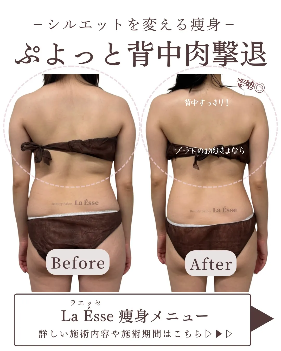 【背中や中半身】自分じゃ何とかできない方おまかせください💪🏻