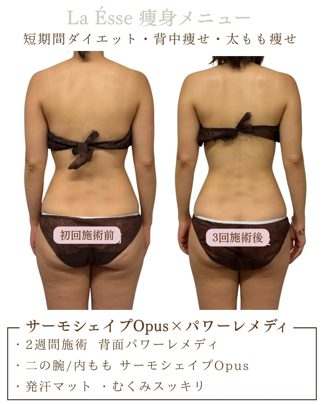 挙式や前撮りまで時間が無い方