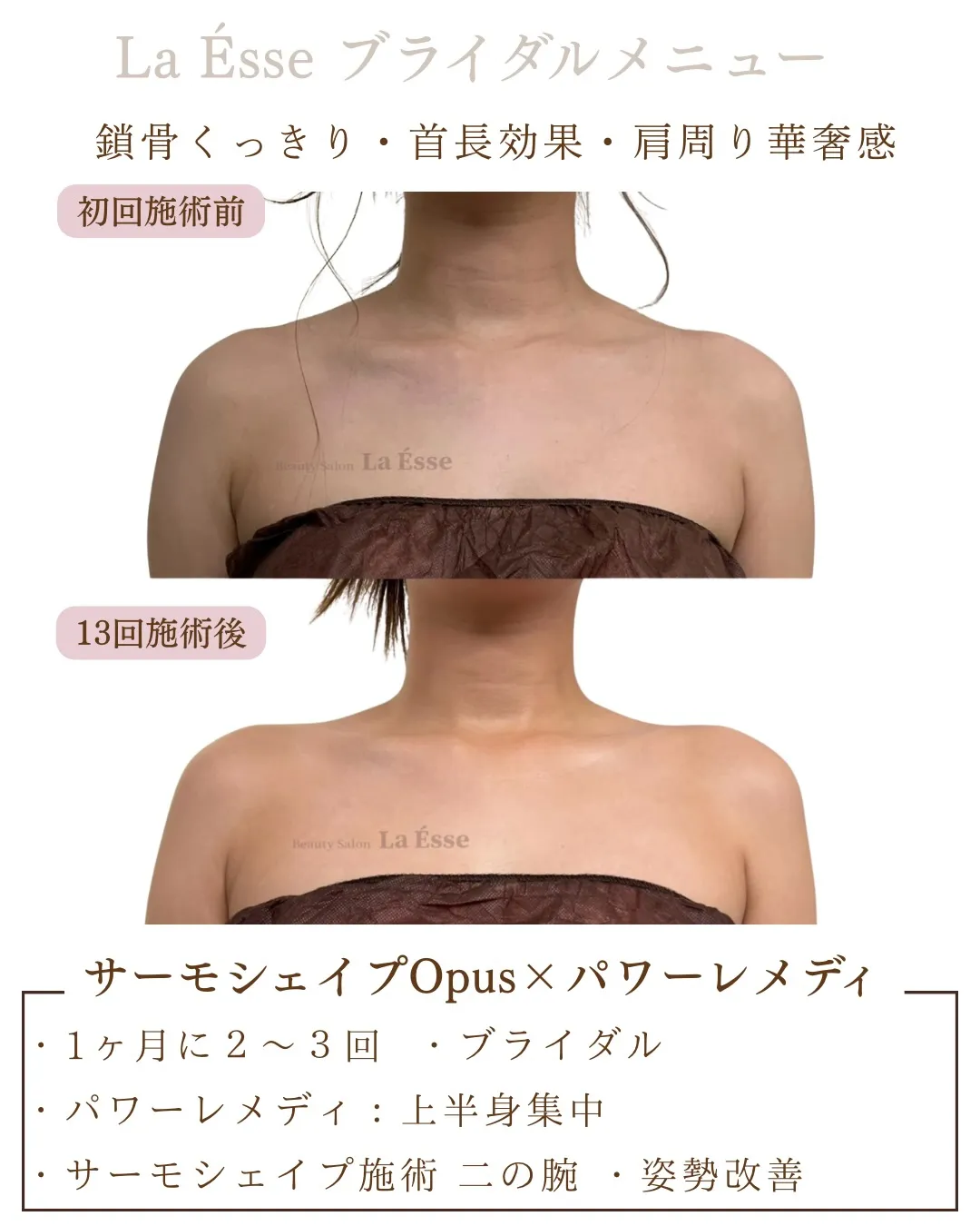 360度どこから見られても、上質な印象を纏う美デコルテ👰🏻‍...