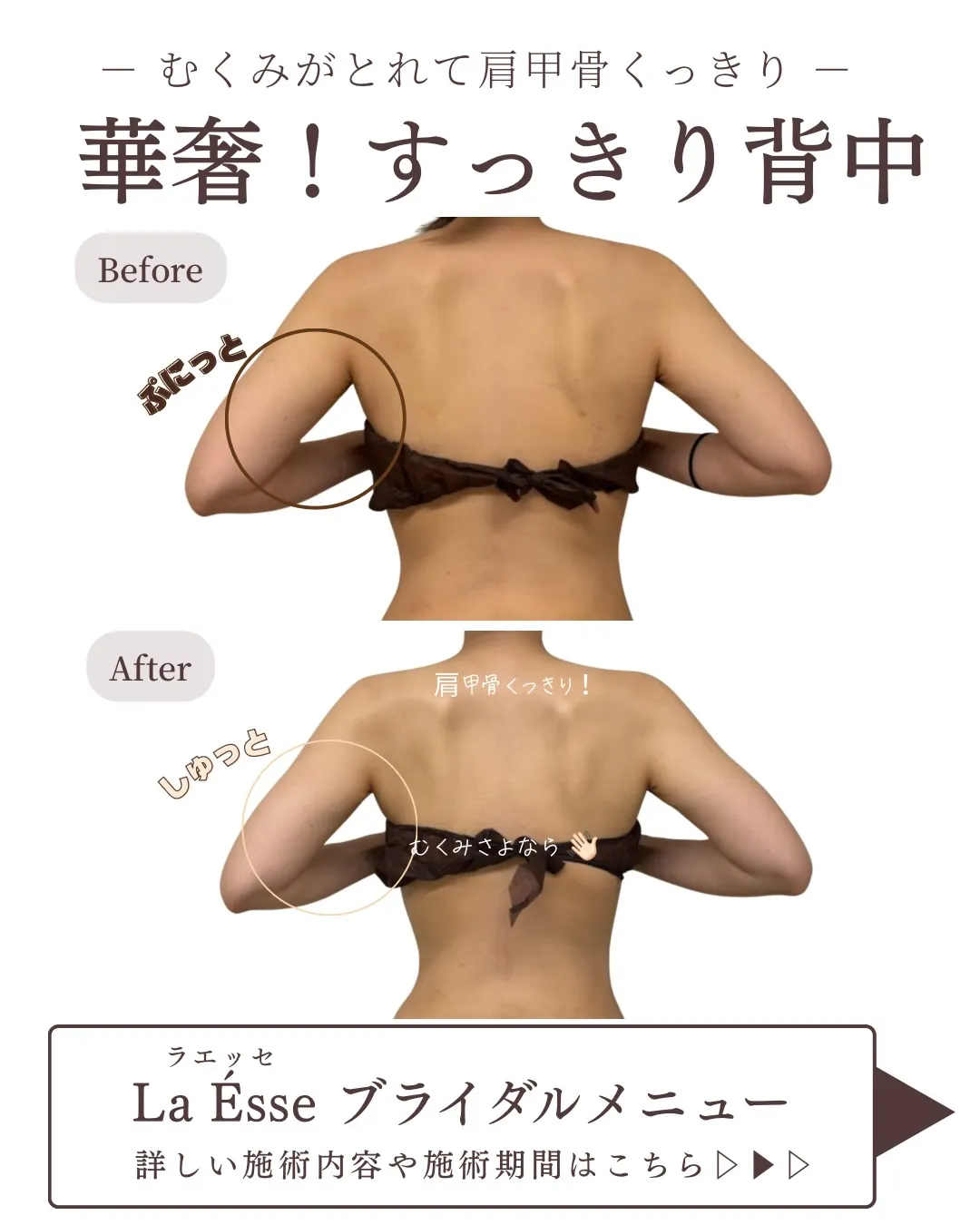 短期間でも後ろ姿が美しく変わるだけで印象が変わる👰🏻‍♀️