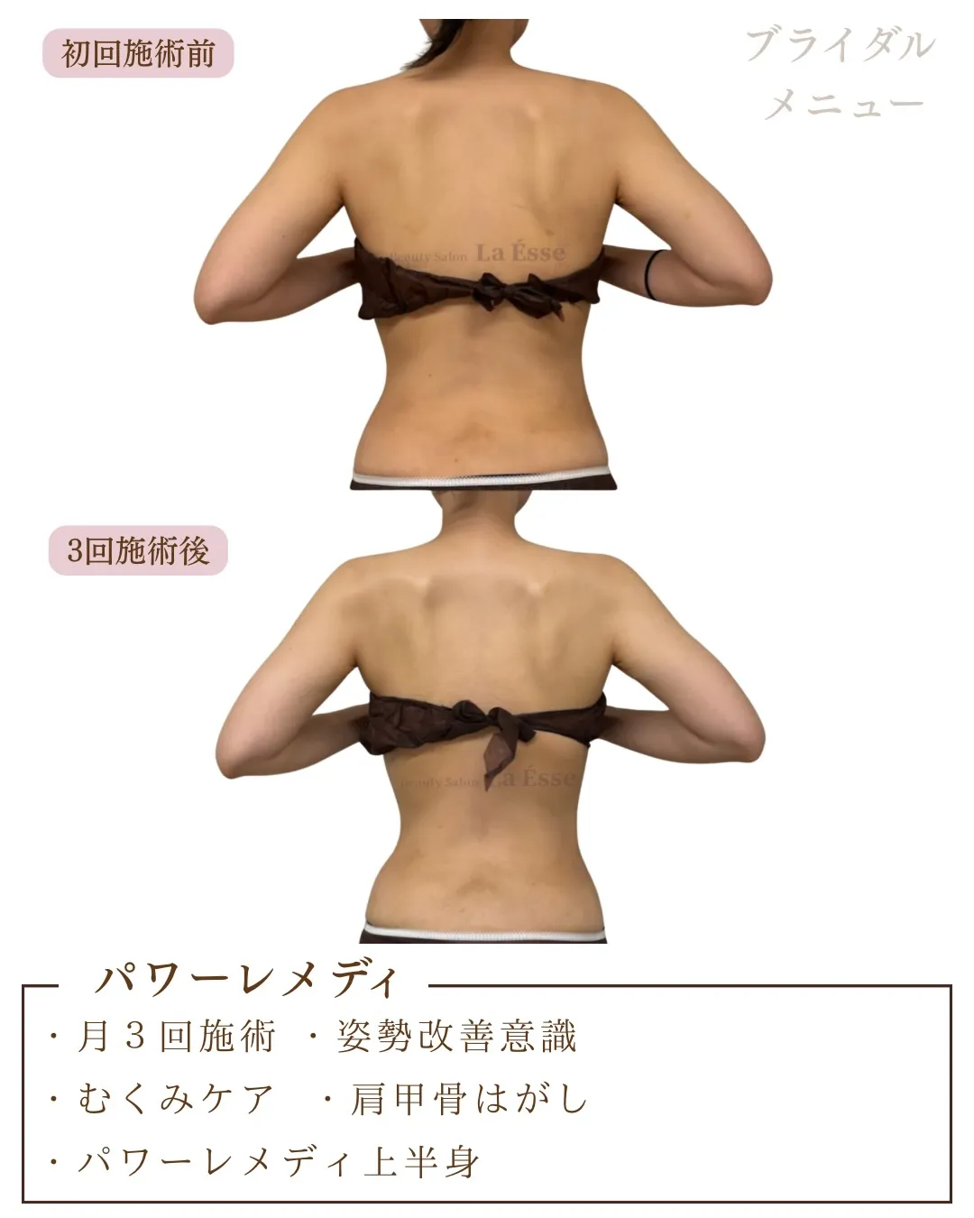 短期間でも後ろ姿が美しく変わるだけで印象が変わる👰🏻‍♀️