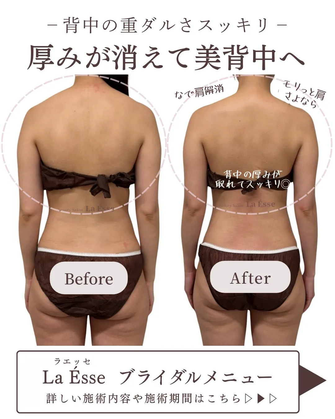 背中の厚みが変わると、後ろ姿の印象はここまで変わる✨