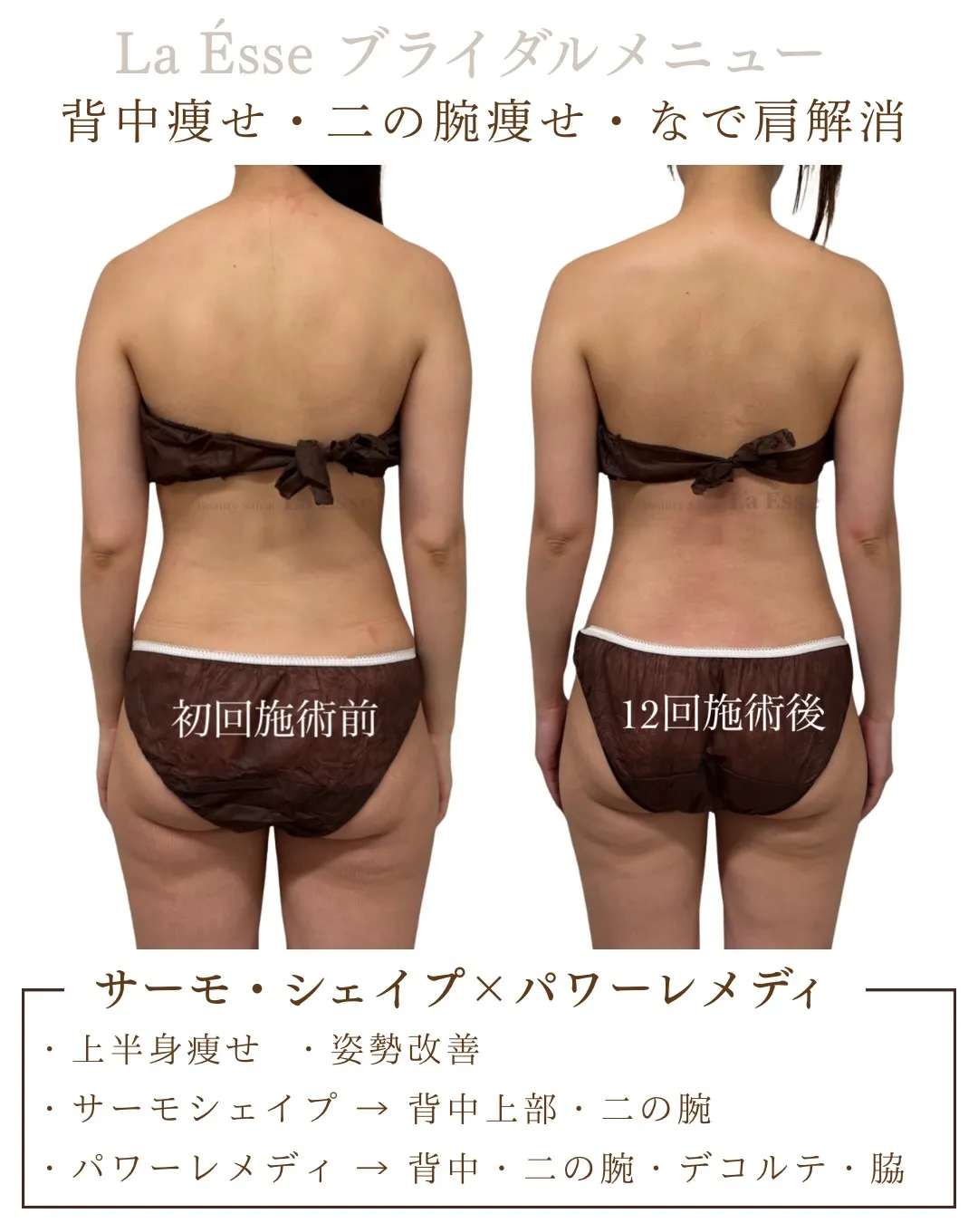 背中の厚みが変わると、後ろ姿の印象はここまで変わる✨