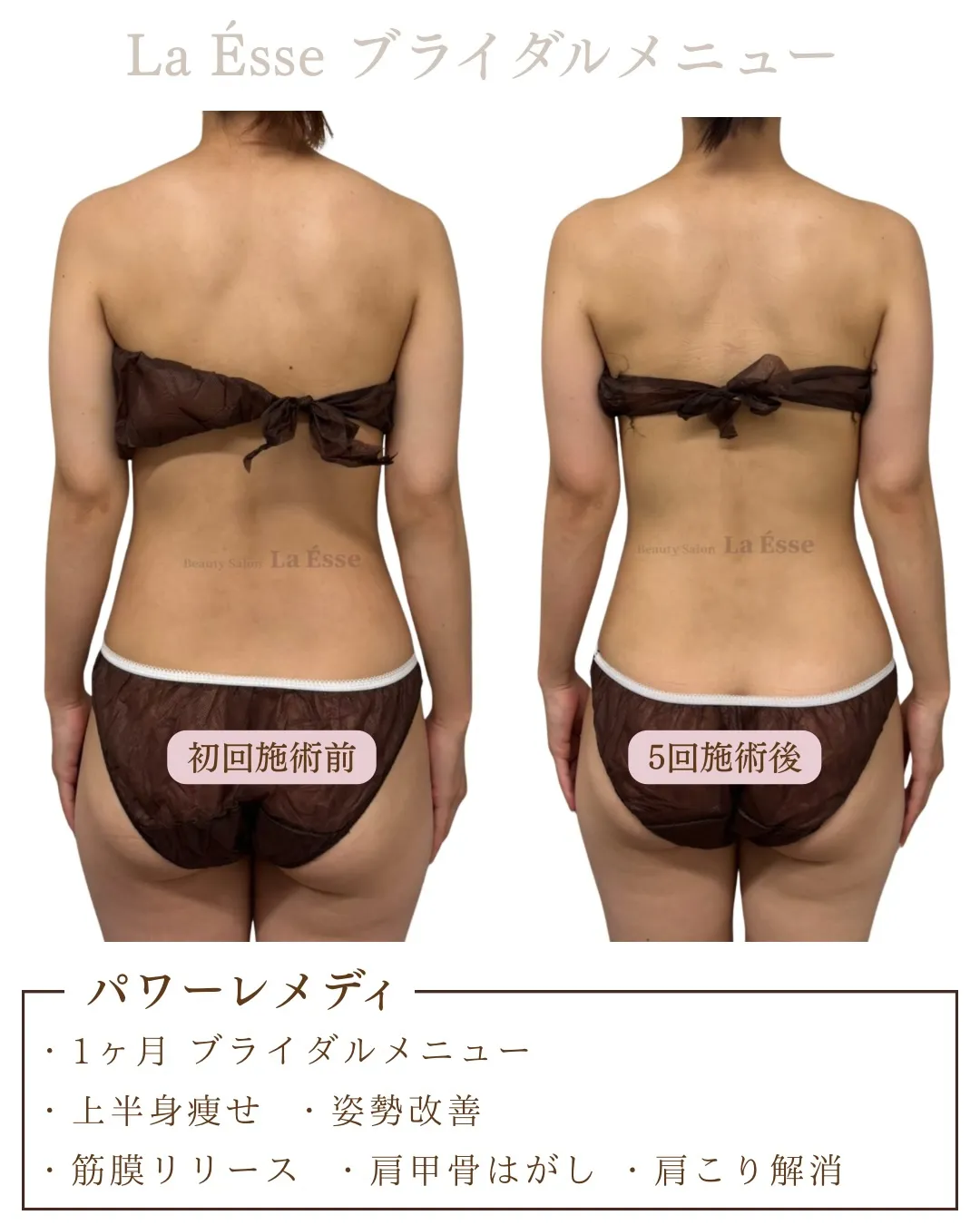 極上筋膜リリース