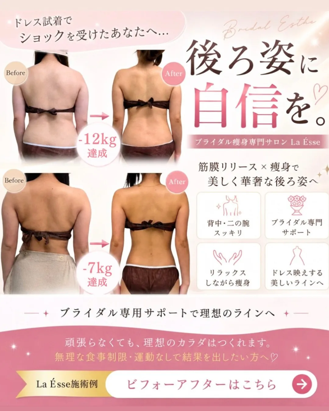 \ 烏丸で上半身のお悩み・ブライダルエステをお探しの方 /