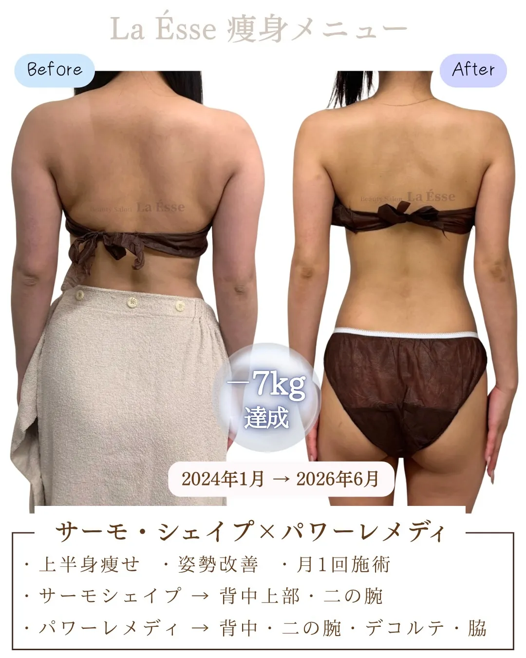 \ 烏丸で上半身のお悩み・ブライダルエステをお探しの方 /