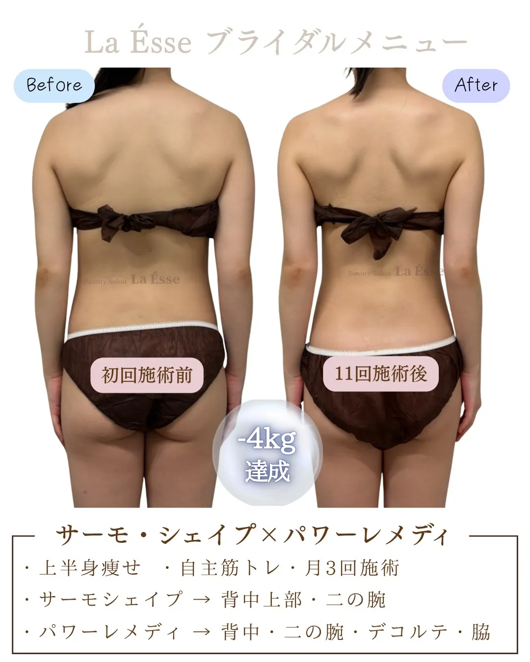 \ 烏丸で上半身のお悩み・ブライダルエステをお探しの方 /
