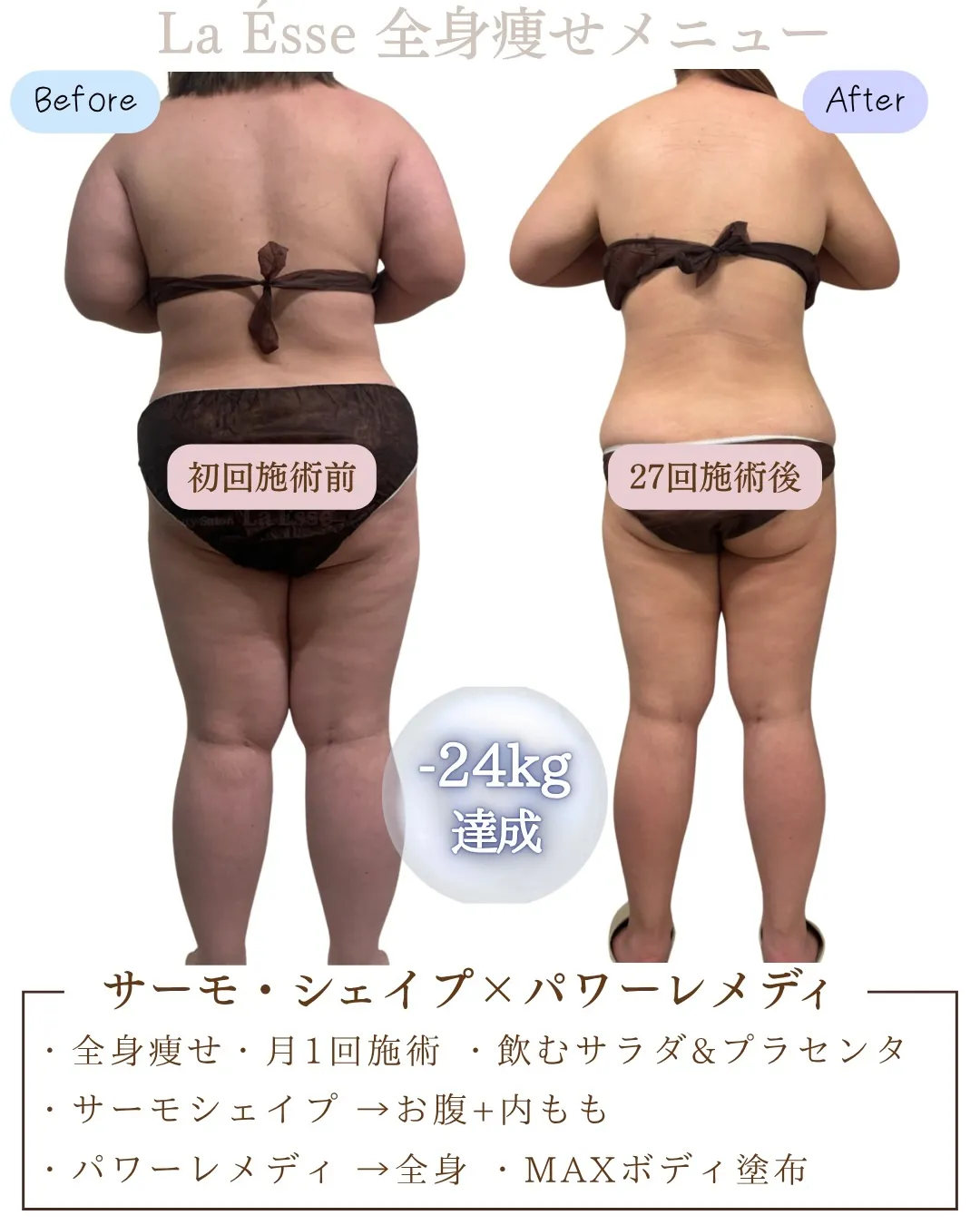 \ 烏丸で上半身のお悩み・ブライダルエステをお探しの方 /