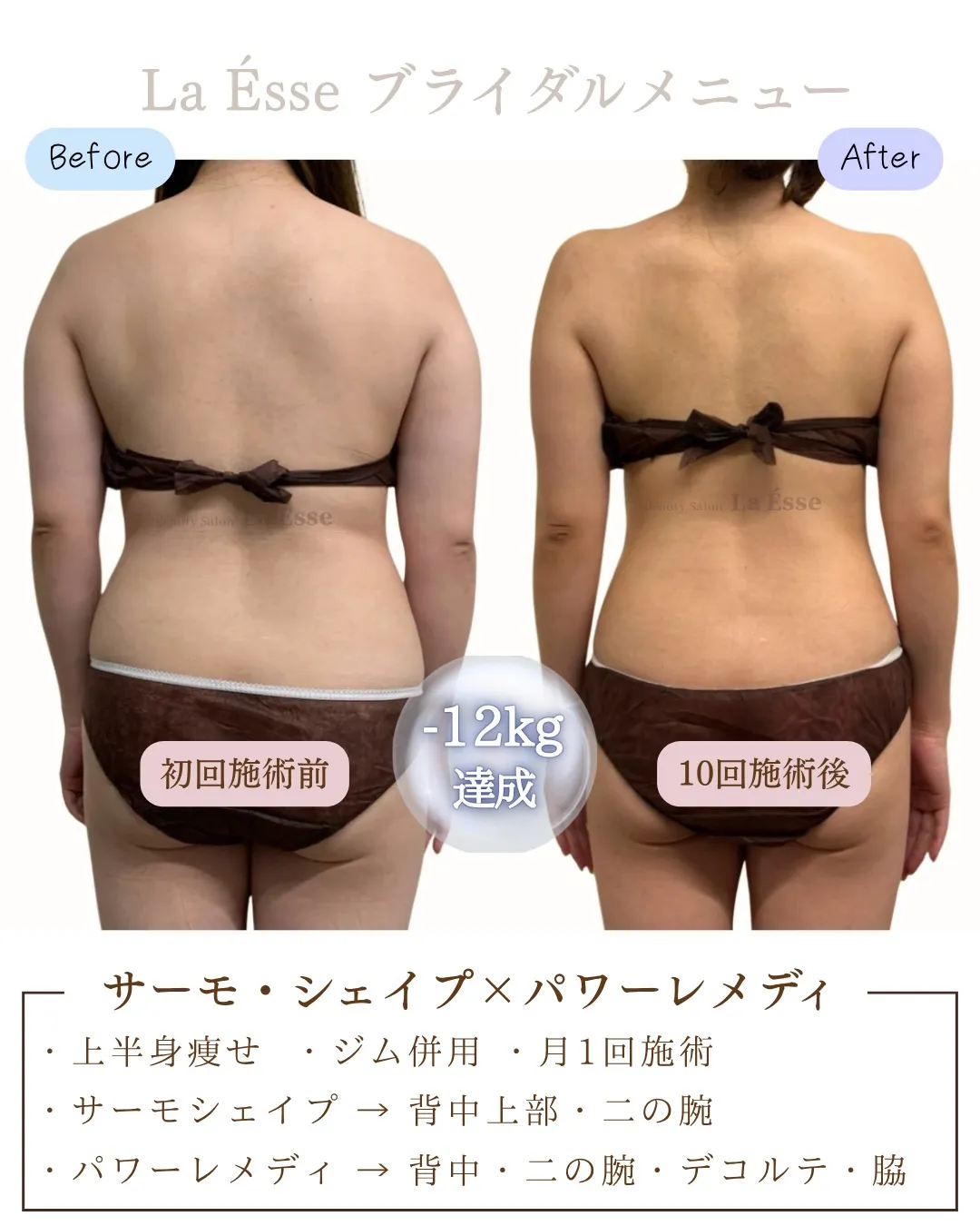 \ 烏丸で上半身のお悩み・ブライダルエステをお探しの方 /
