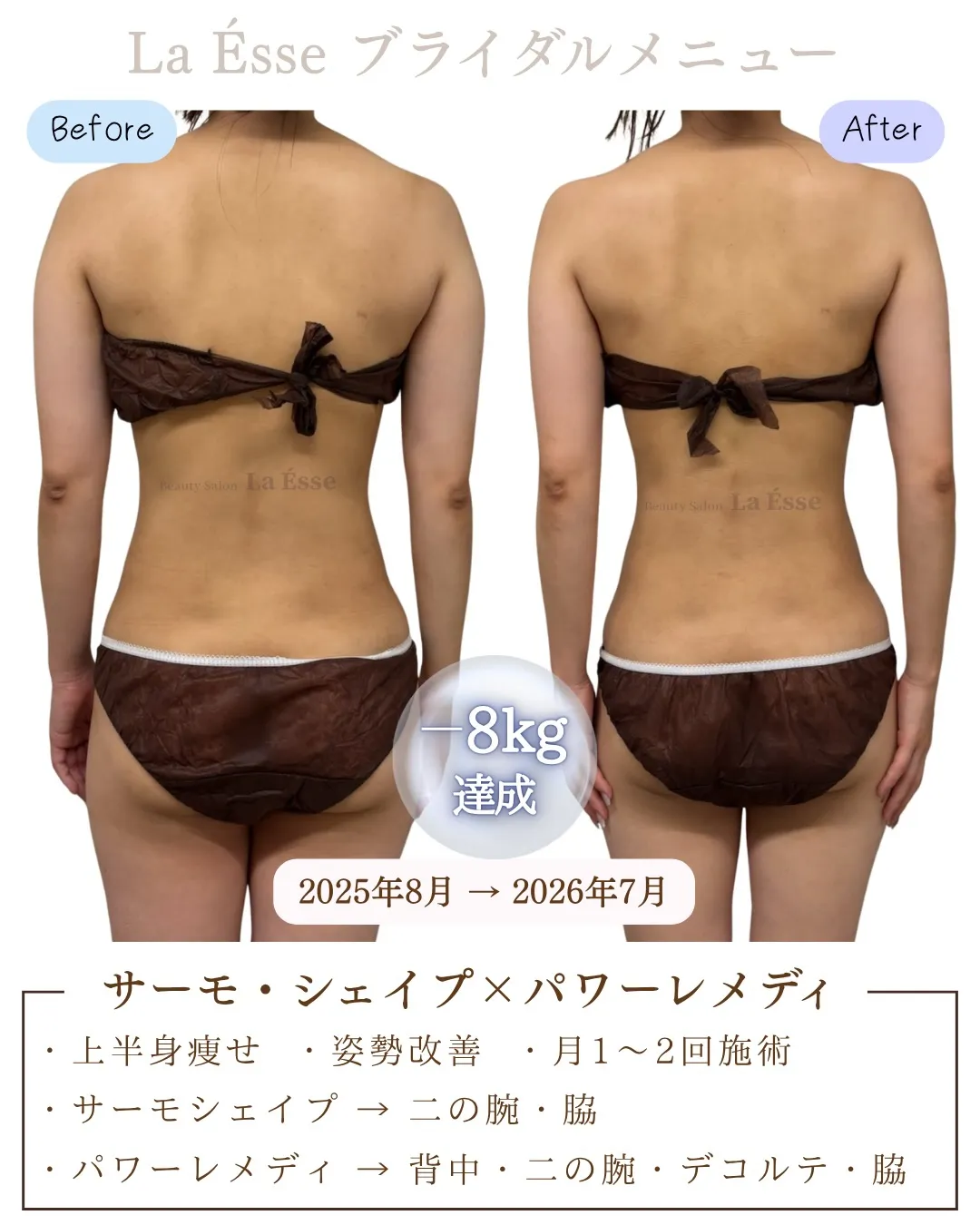 \ 烏丸で上半身のお悩み・ブライダルエステをお探しの方 /