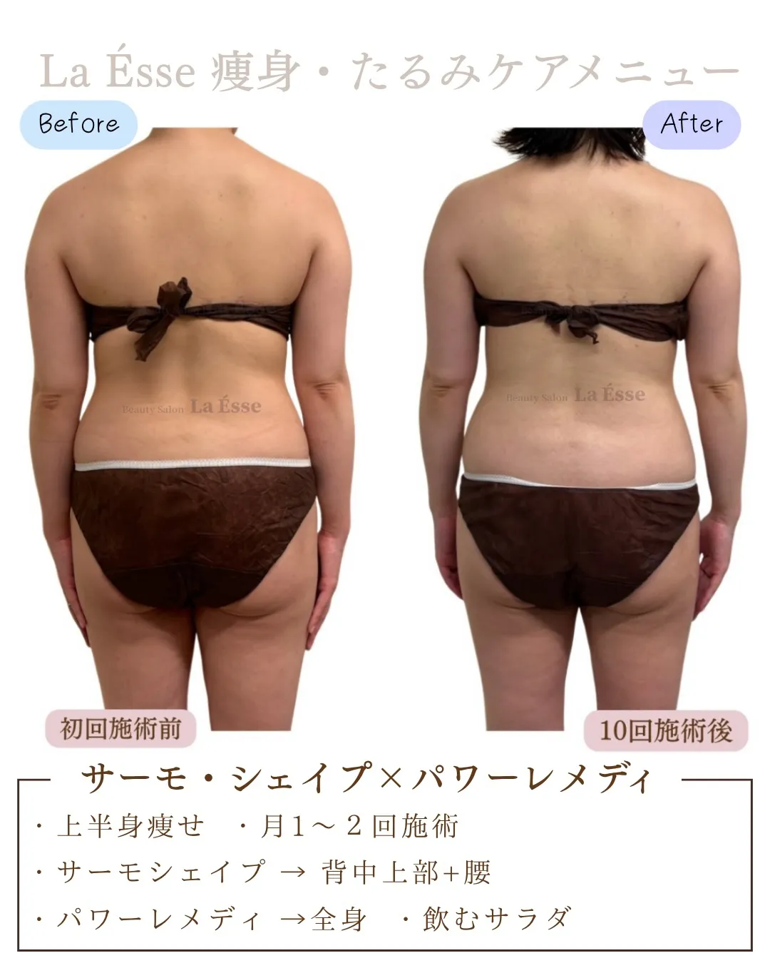 \ 烏丸で上半身のお悩み・ブライダルエステをお探しの方 /