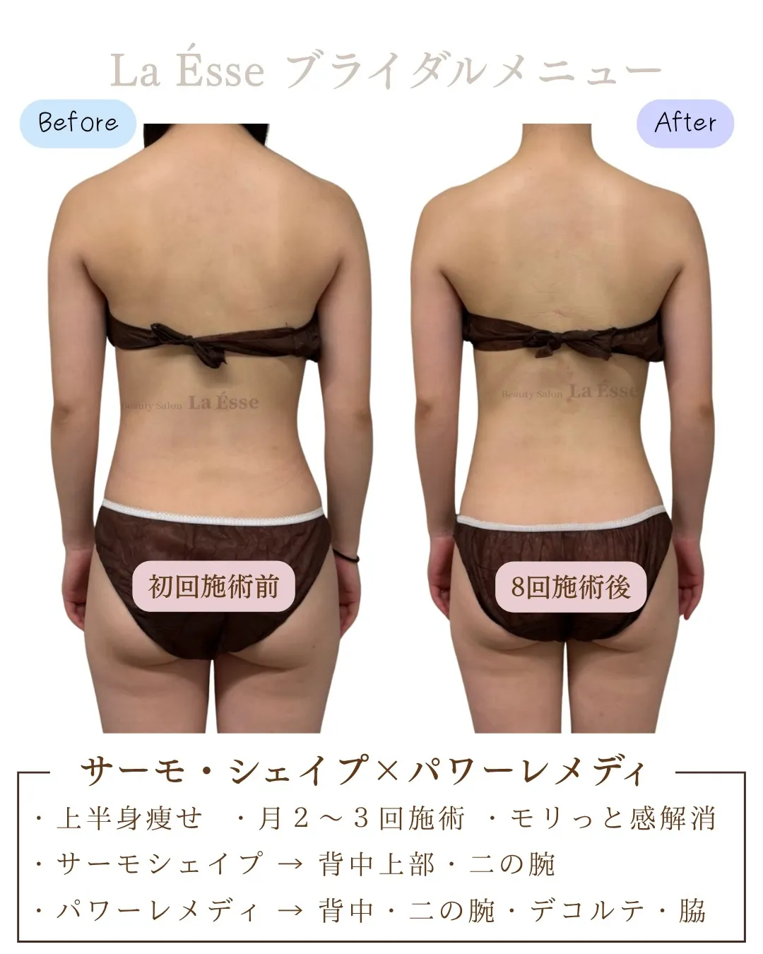 \ 烏丸で上半身のお悩み・ブライダルエステをお探しの方 /
