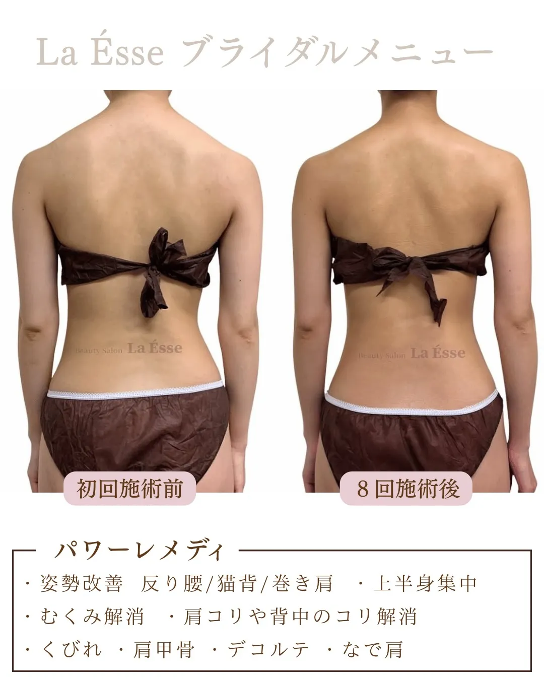 背中のモリっと感解消！スッキリした後ろ姿へ👰🏻‍♀️🩵