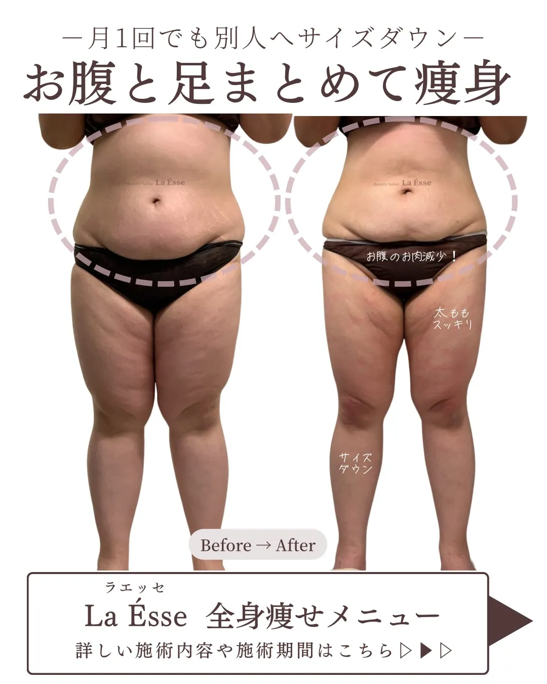 頑張りすぎない痩身で全身痩せを叶える！👏🏻✨🪄