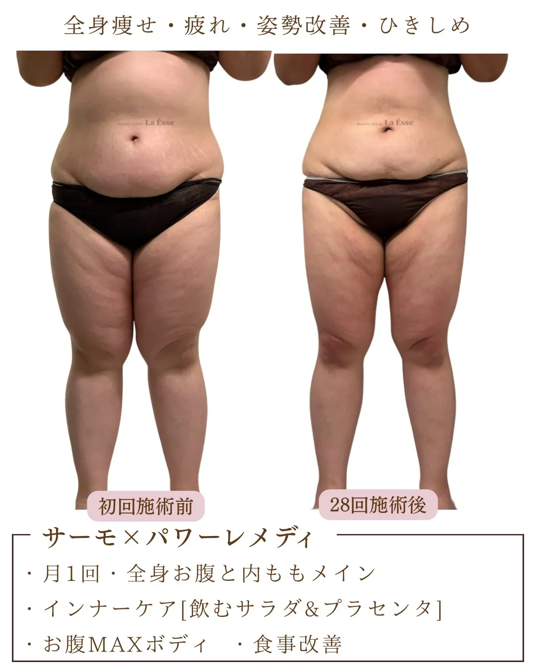 頑張りすぎない痩身で全身痩せを叶える！👏🏻✨🪄