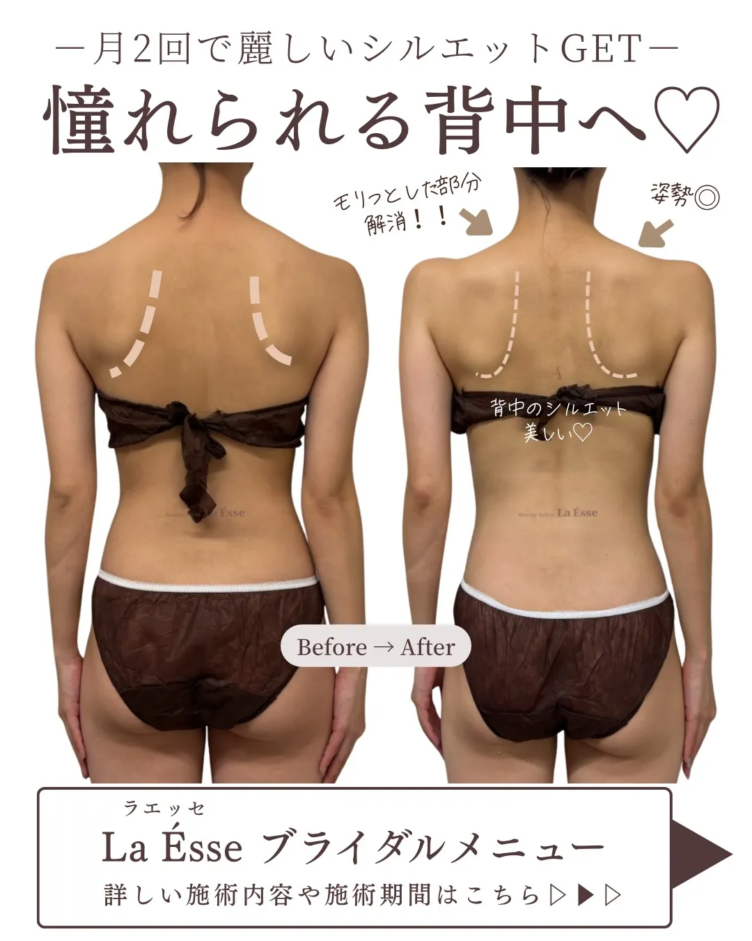 花嫁様必見!華奢感はつくれます👰🏻♀️✨